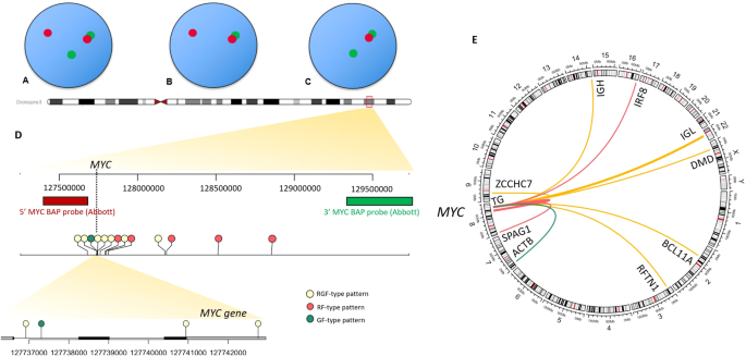 Unraveling the genomic underpinnings of unbalanced MYC break-apart FISH results using whole genome sequencing analysis