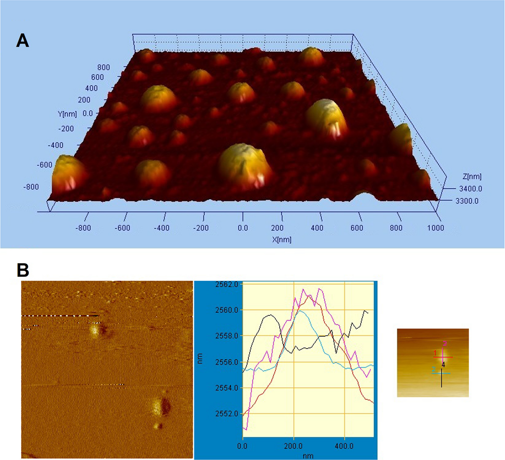 In vitro and in vivo evaluation of nanoliposomes loading quercetin and 3-bromopyruvate against glioma