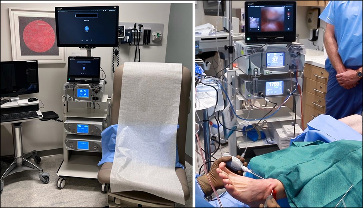 In-Office Needle Arthroscopy: Indications, Surgical Techniques, Tips, and Tricks