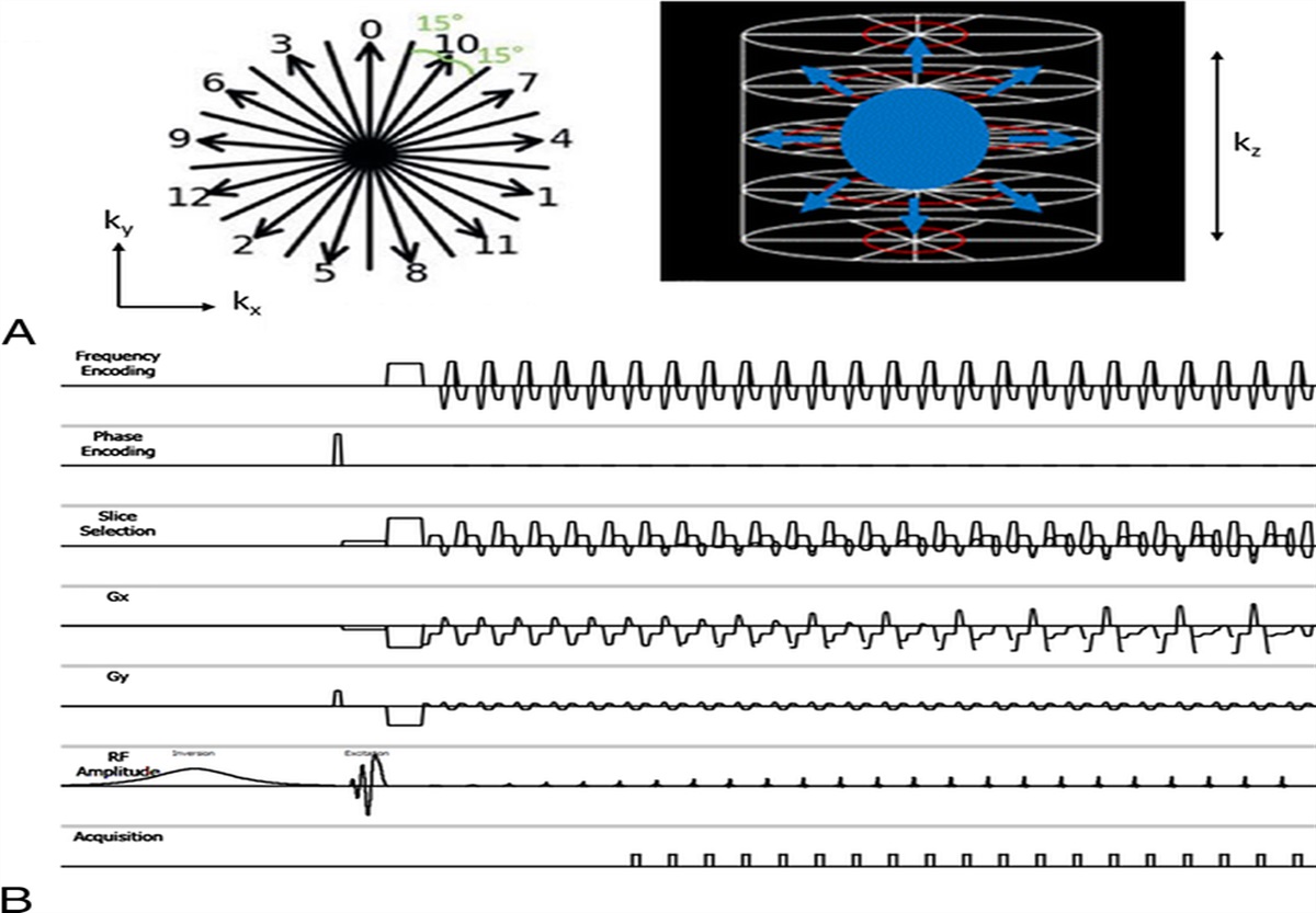 Feasibility and Implementation of a 4D Free-Breathing Variable Density Stack-of-Stars Functional Magnetic Resonance Urography in Young Children Without Sedation