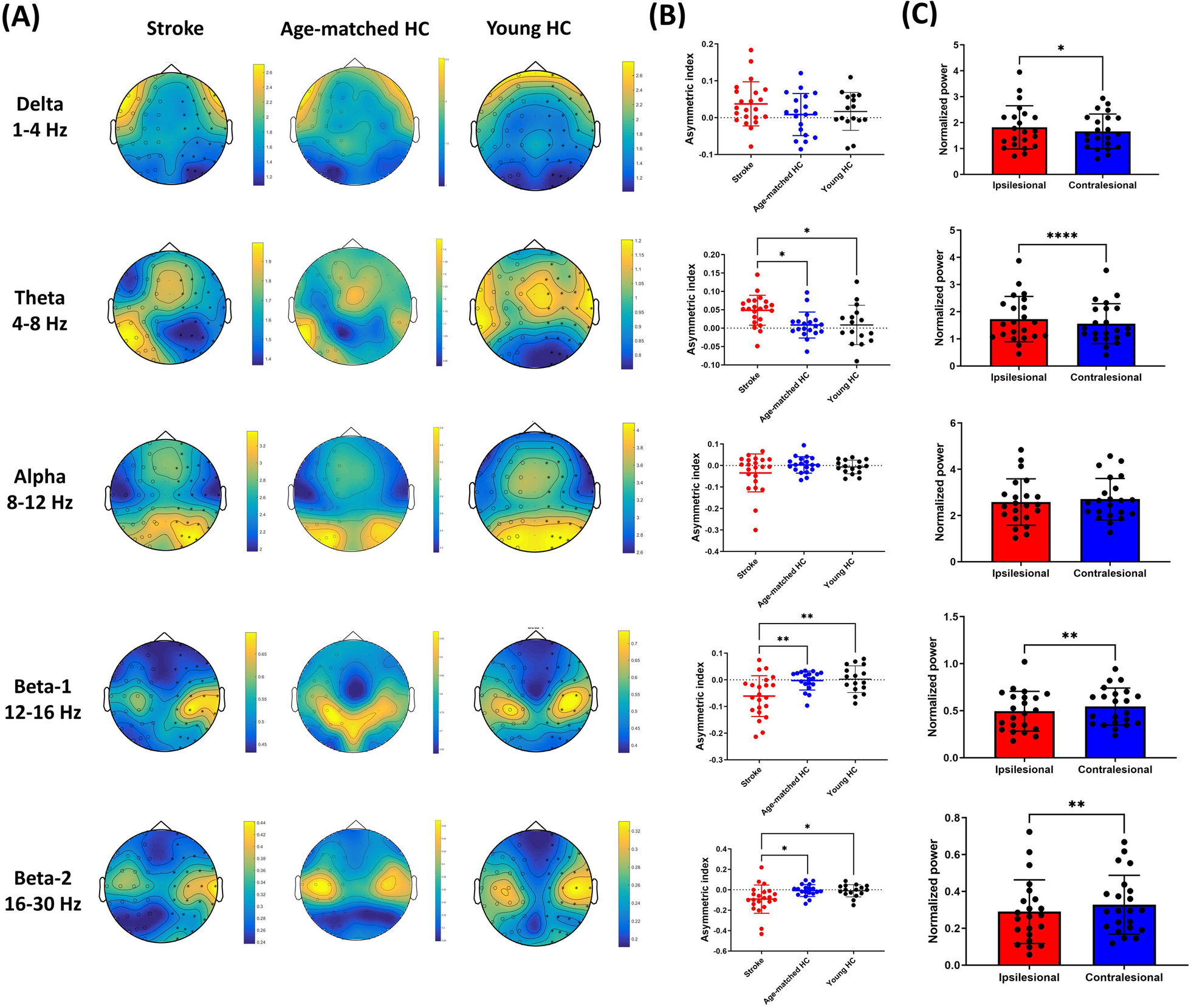 Resting-state cortical electroencephalogram rhythms and network in patients after chronic stroke