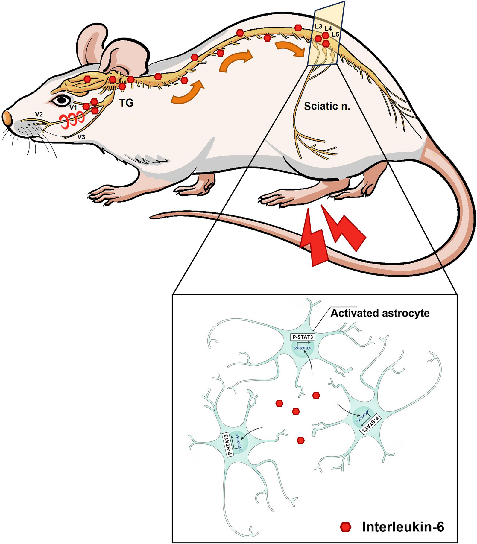 IL-6 from cerebrospinal fluid causes widespread pain via STAT3-mediated astrocytosis in chronic constriction injury of the infraorbital nerve