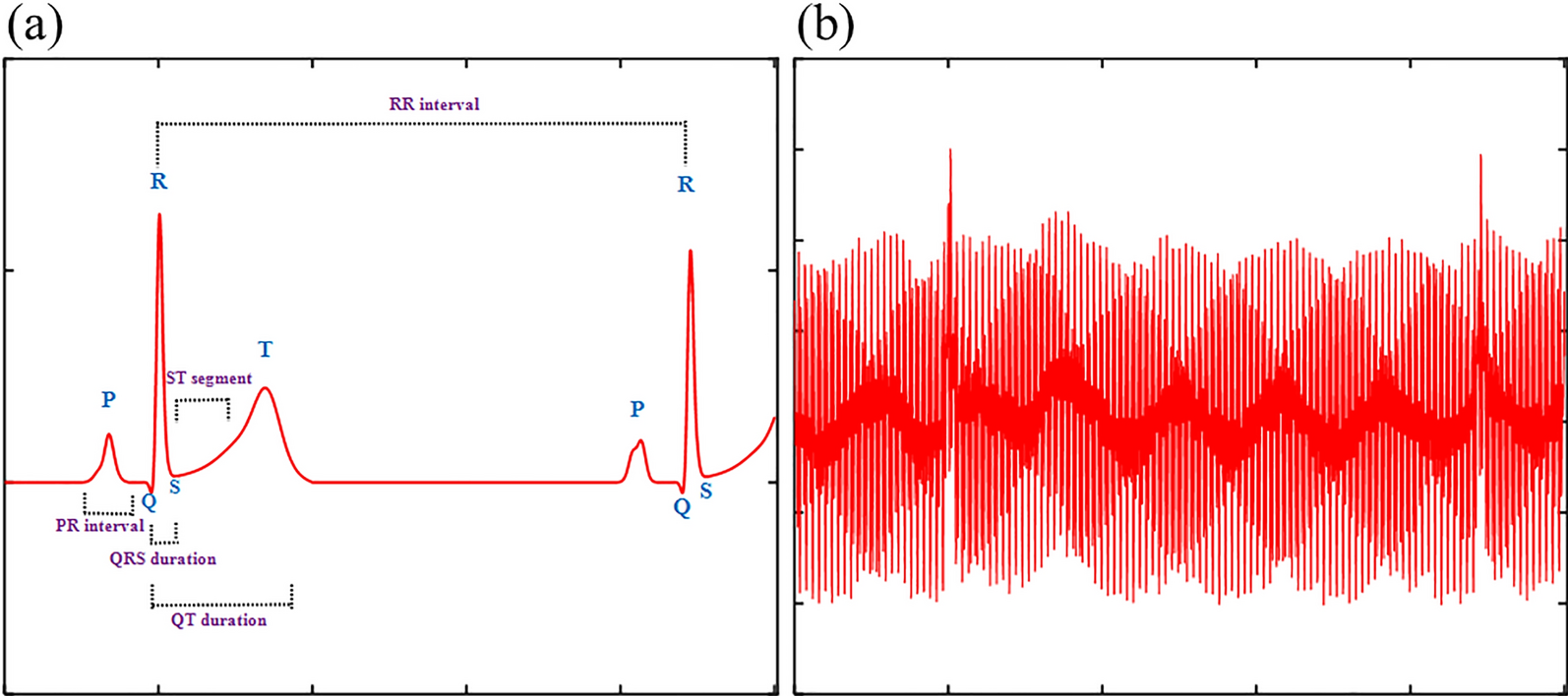 MEAs-Filter: a novel filter framework utilizing evolutionary algorithms for cardiovascular diseases diagnosis