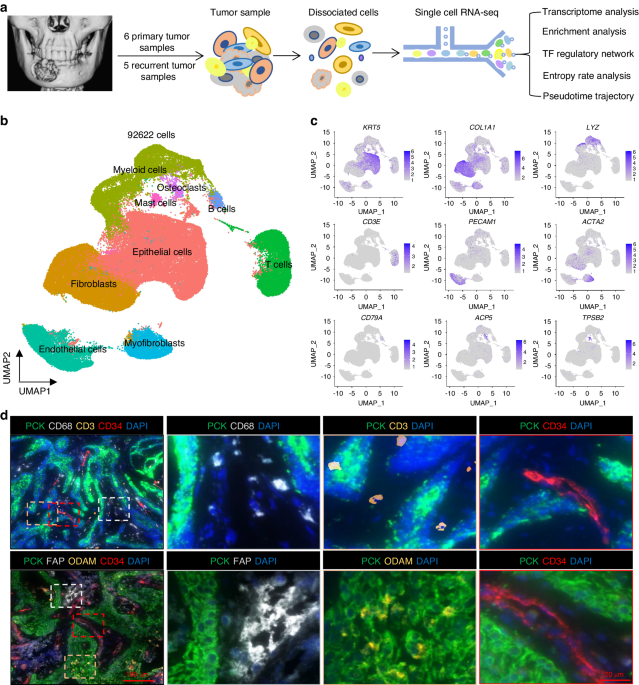 Single-cell transcriptomics reveals cell atlas and identifies cycling tumor cells responsible for recurrence in ameloblastoma