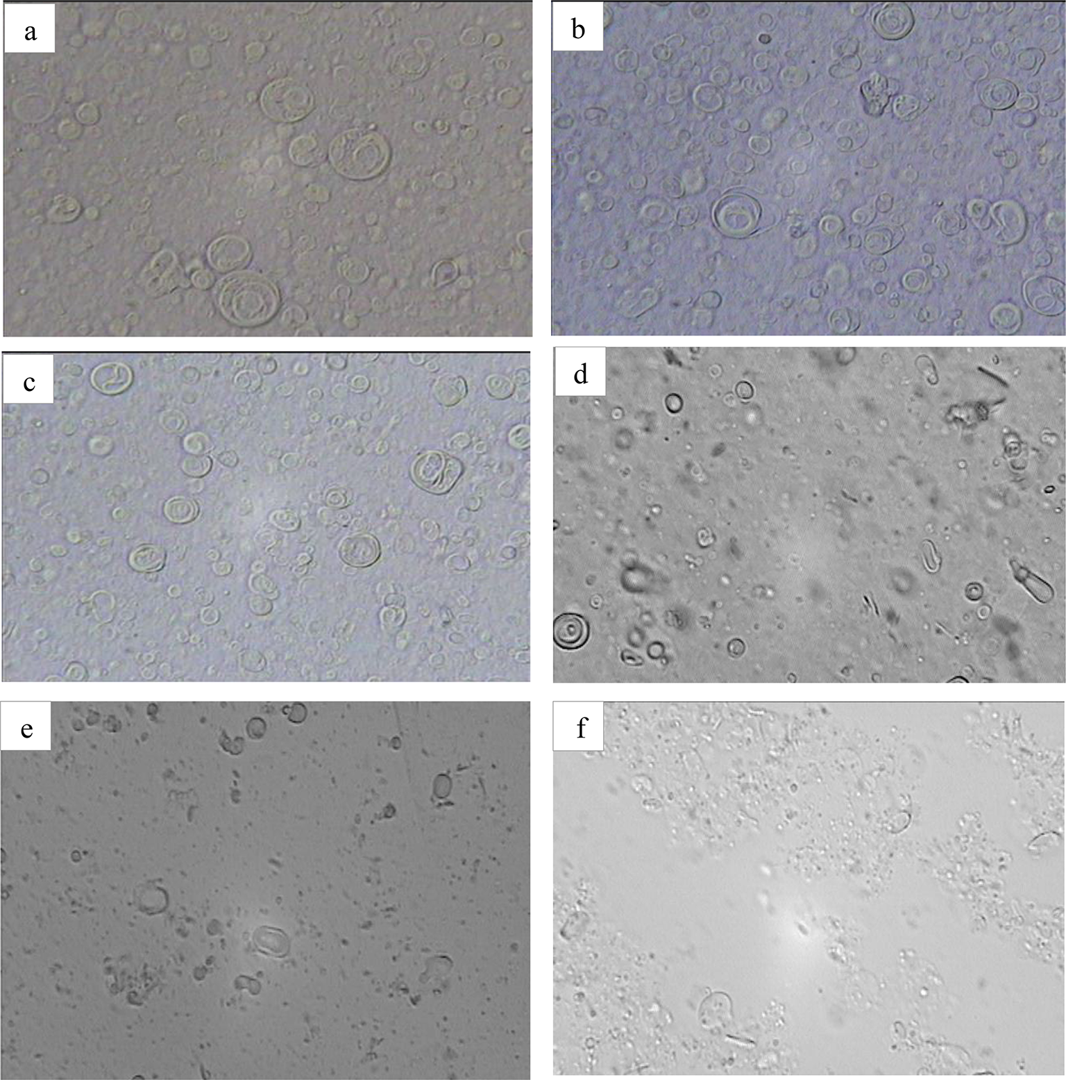 Preparation and Physicochemical Characterizations of Niosomal Benzoyl Peroxide and Clindamycin Phosphate Formulation for Acne Vulgaris