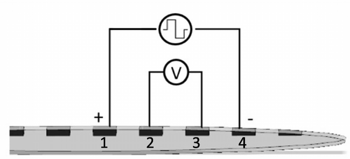 Four-Point Impedance: A Potential Biomarker for Residual Hearing After Cochlear Implantation