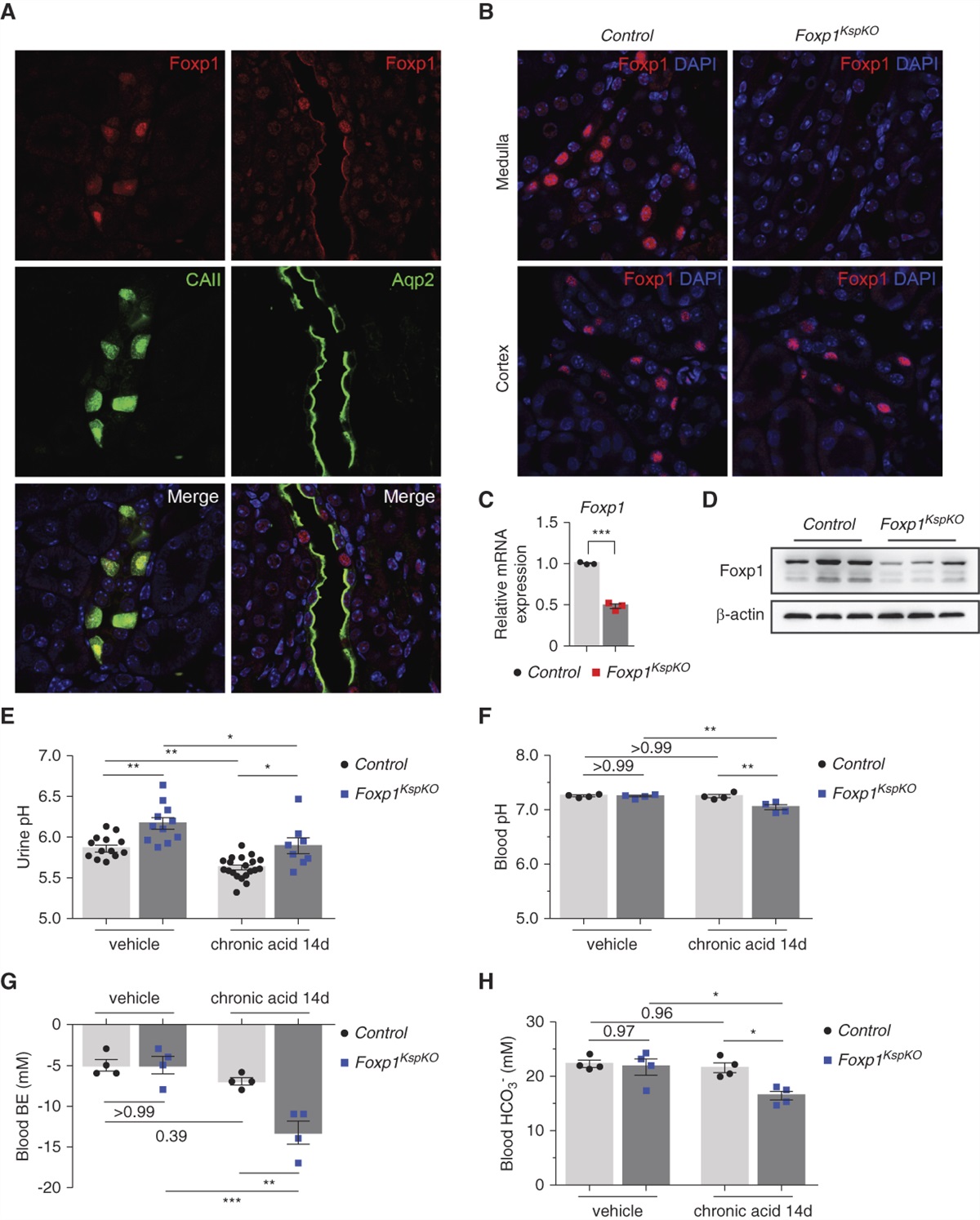Foxp1 is Required for Renal Intercalated Dell Differentiation and Acid-Base Regulation