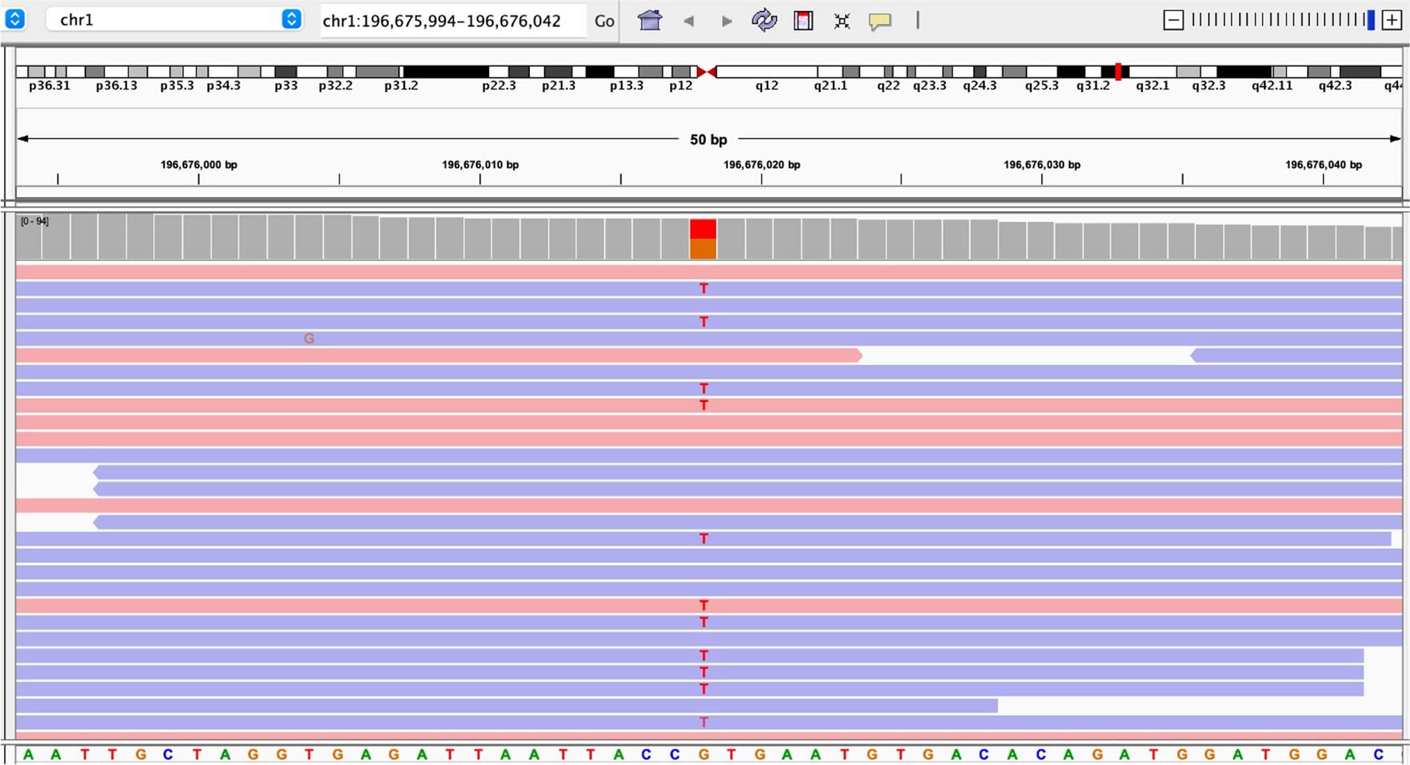 Low C3 in a 4-month-old baby: is it a problem?