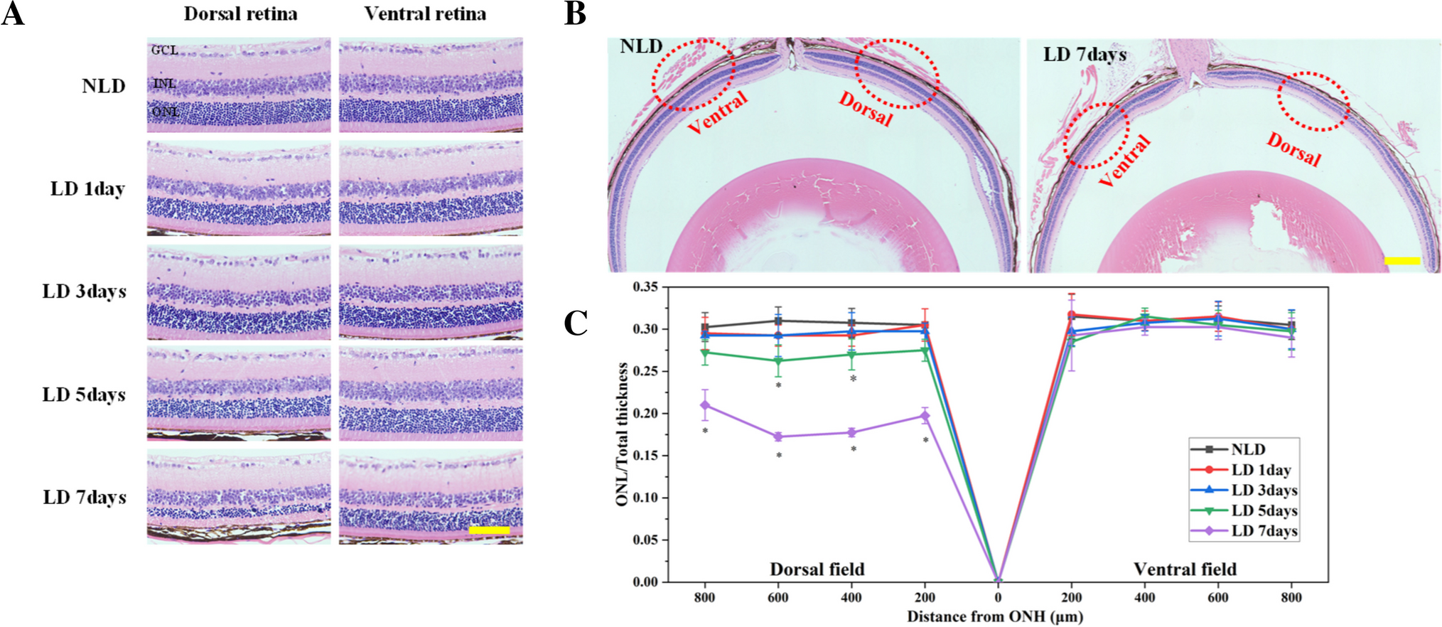 Purinergic P2X7 receptor involves in anti-retinal photodamage effects of berberine