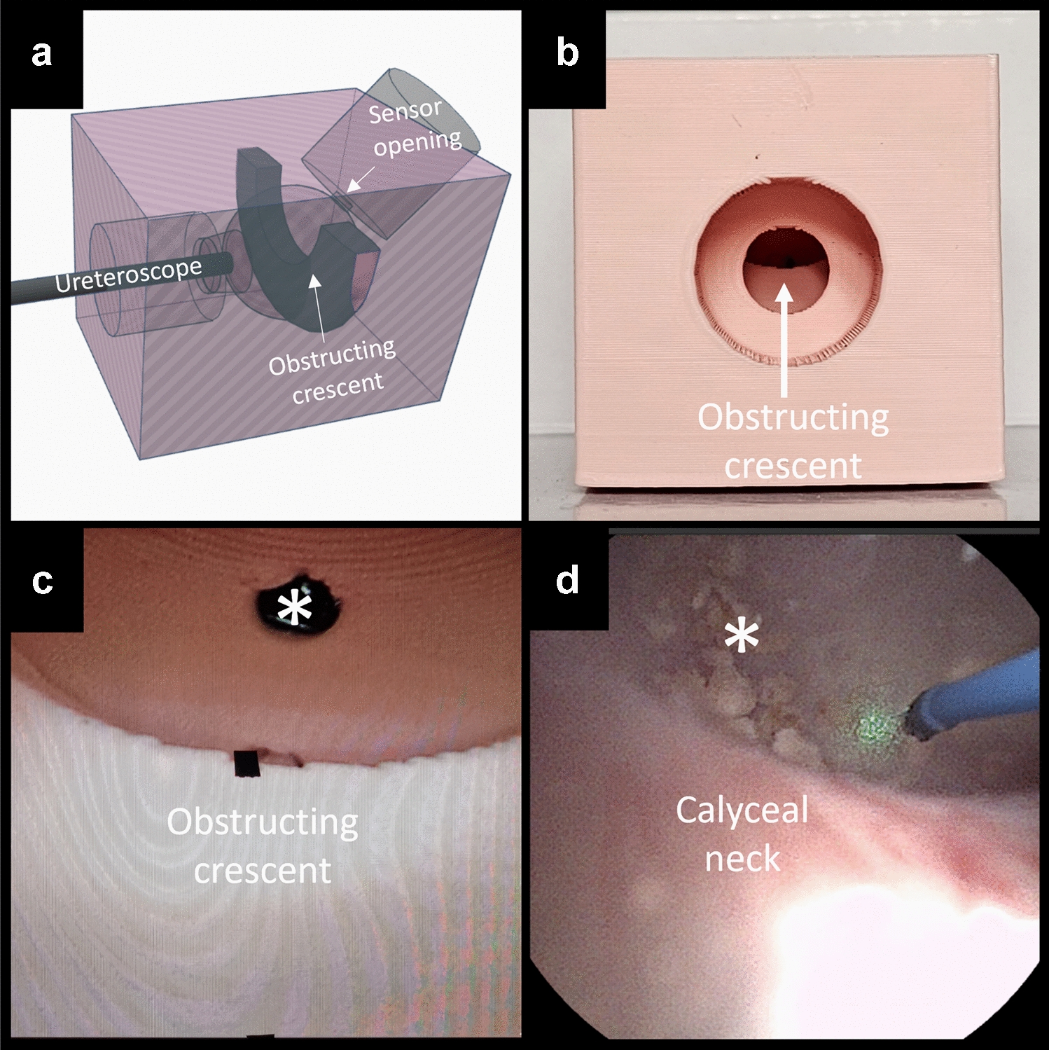Illumination matters Part III: Impact of light obstruction on illuminance from flexible ureteroscopes — a comparative PEARLS analysis