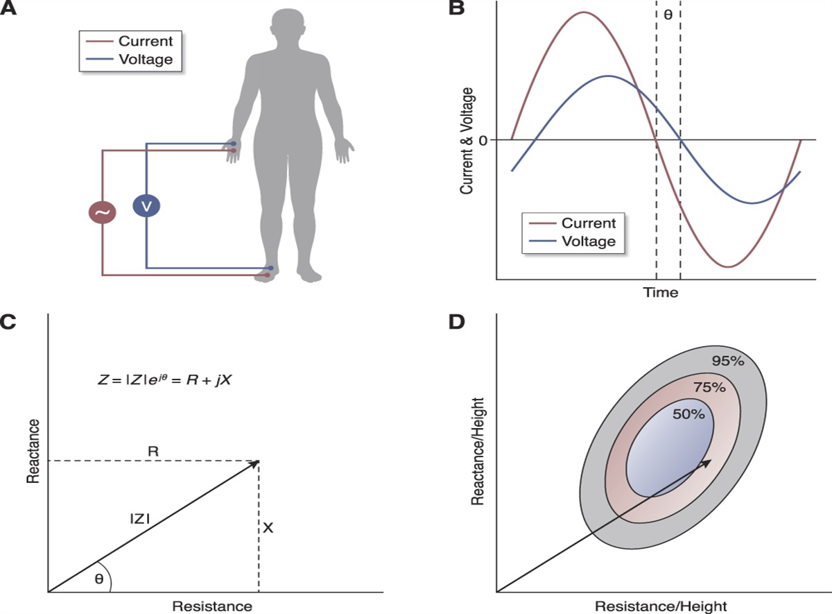 Mechanistic Basis for Intradialytic Hypertension with Hemodialysis