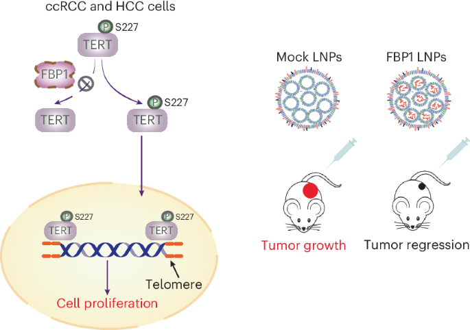 Fructose-1,6-bisphosphatase 1 dephosphorylates and inhibits TERT for tumor suppression