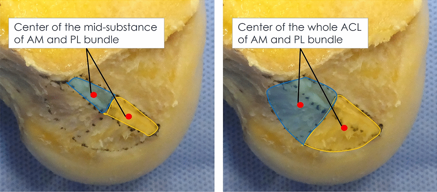 Evaluation of the Angle Between the Long Axis of the Femoral Anterior Cruciate Ligament Footprint and Bony Morphology of the Knee: A Cadaveric Descriptive Study