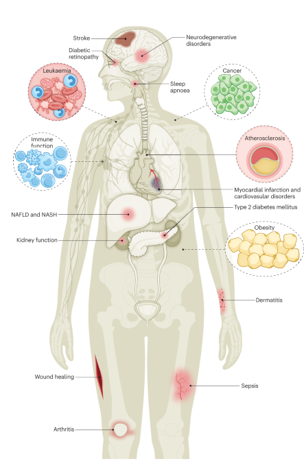 Protein tyrosine phosphatase 1B in metabolic diseases and drug development