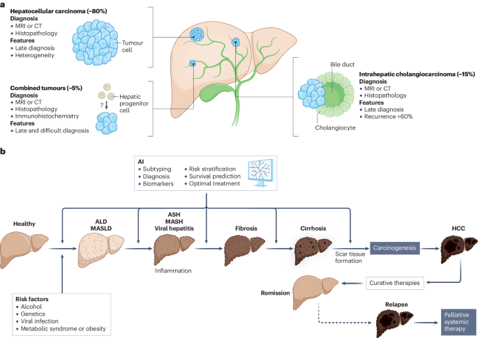 Artificial intelligence in liver cancer — new tools for research and patient management