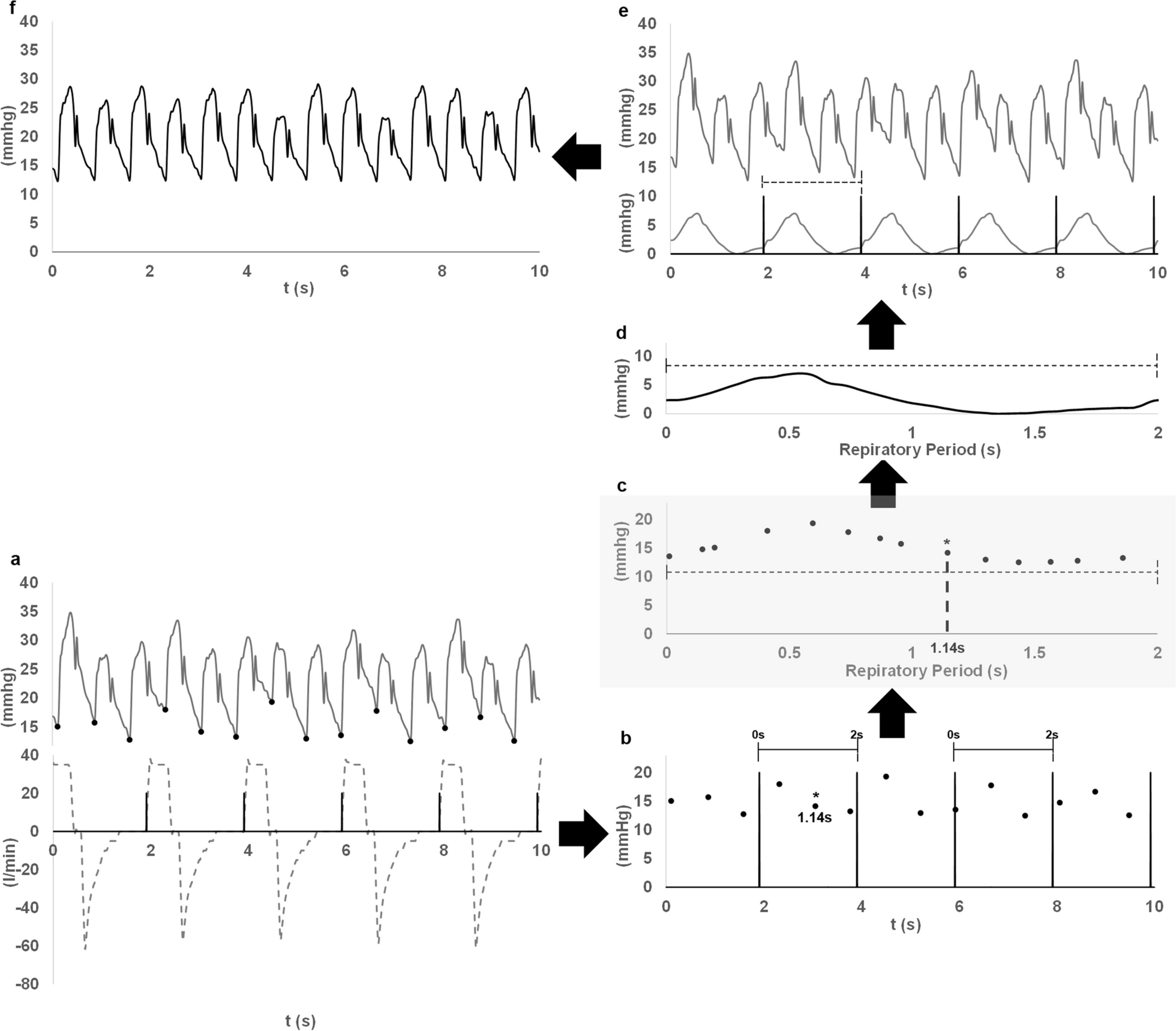 Impact of respiratory cycle during mechanical ventilation on beat-to-beat right ventricle stroke volume estimation by pulmonary artery pulse wave analysis