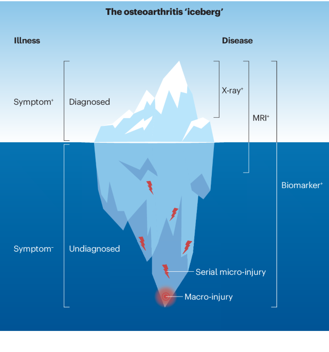 Molecular biomarker approaches to prevention of post-traumatic osteoarthritis