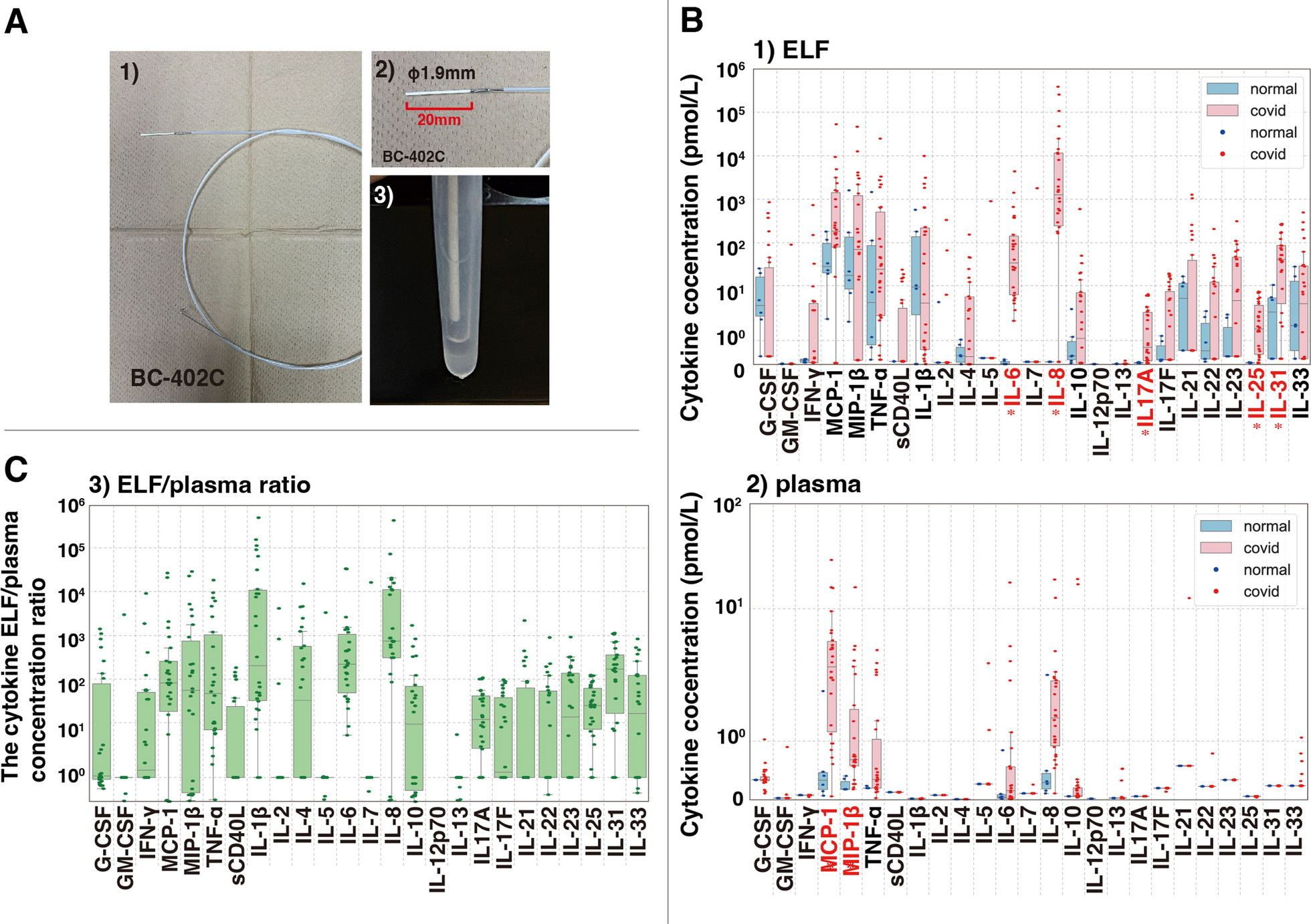 Case study observational research: inflammatory cytokines in the bronchial epithelial lining fluid of COVID-19 patients with acute hypoxemic respiratory failure