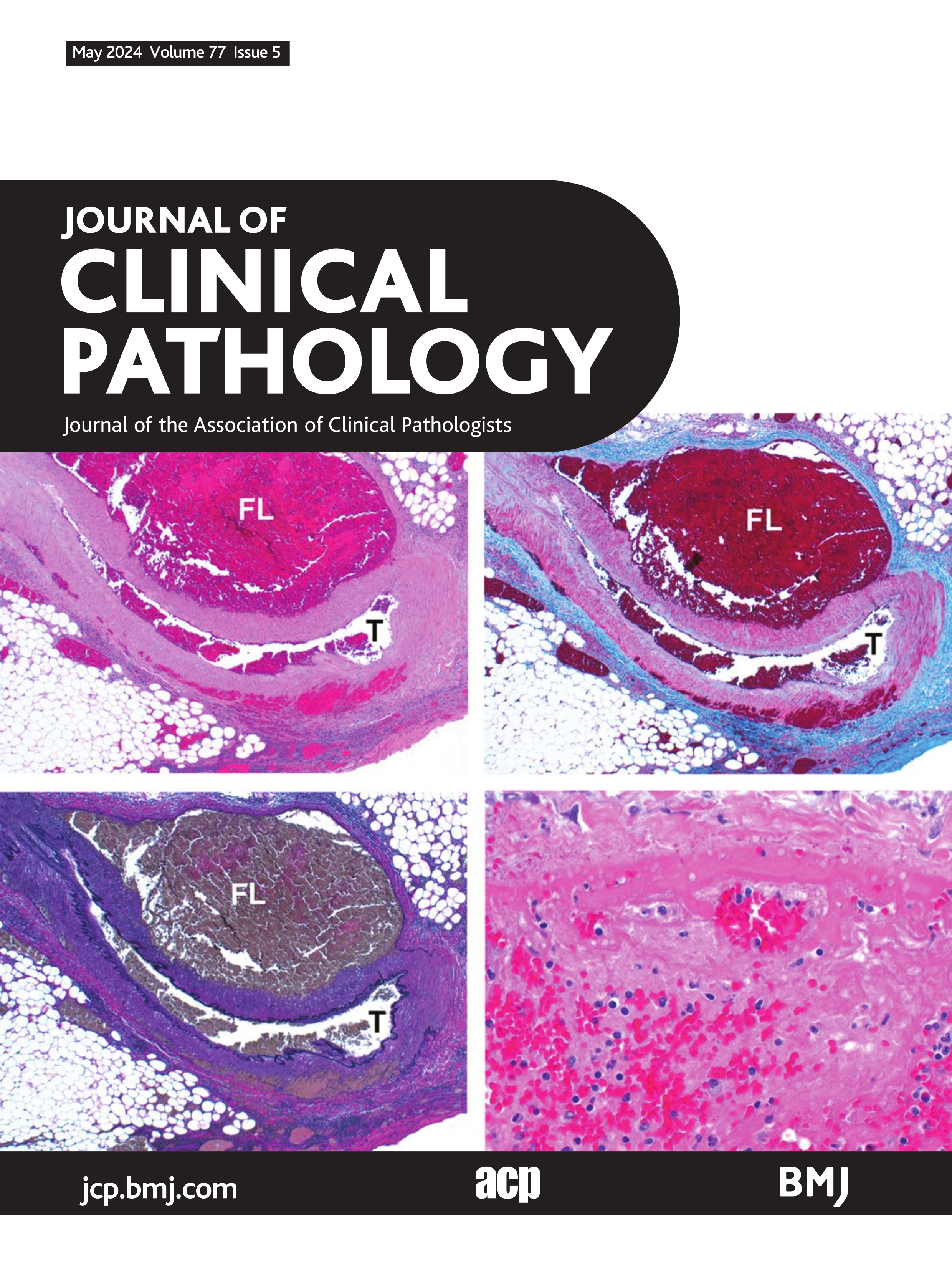 Invited commentary on: sudden cardiac death