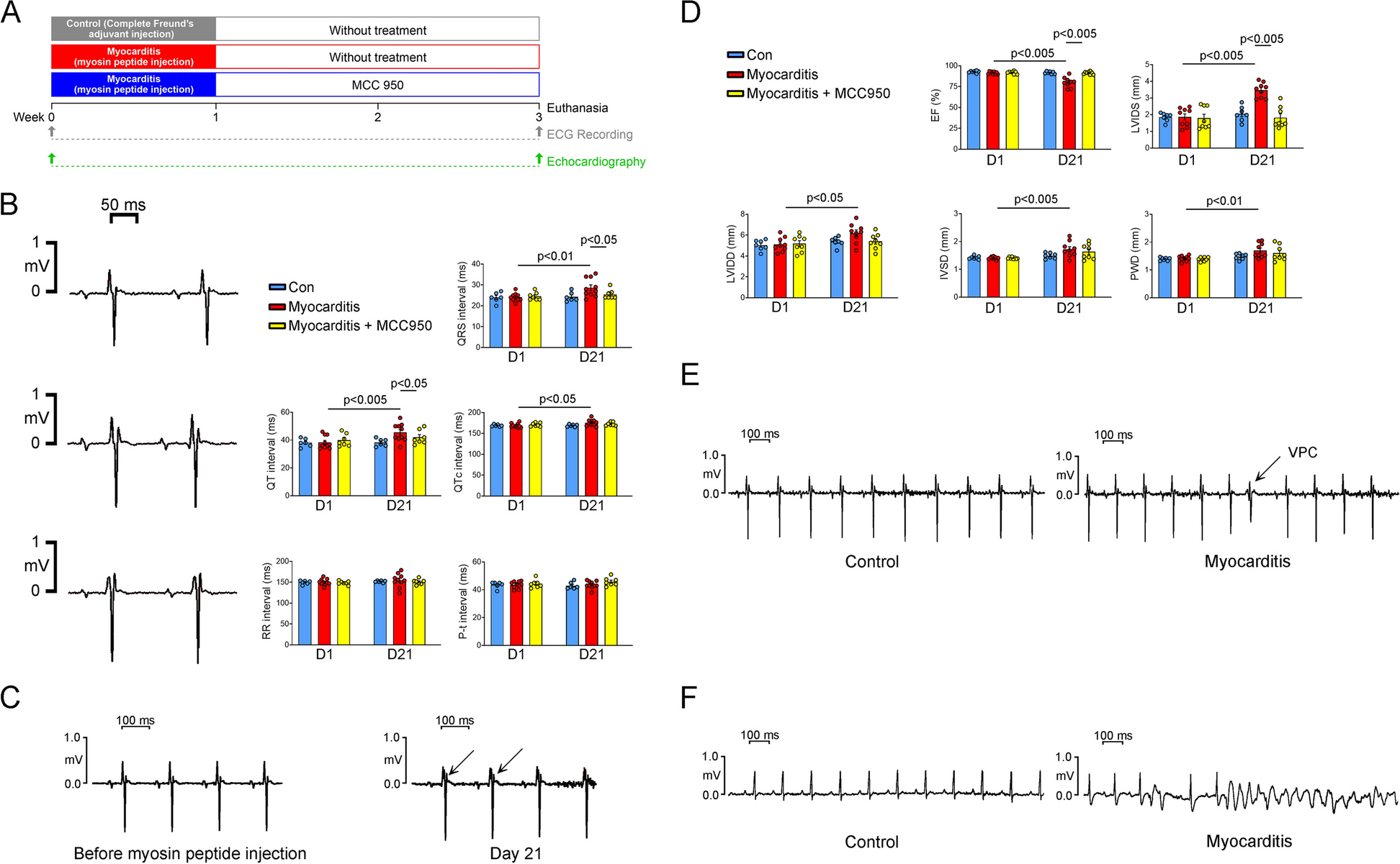 Targeting NLRP3 signaling reduces myocarditis-induced arrhythmogenesis and cardiac remodeling