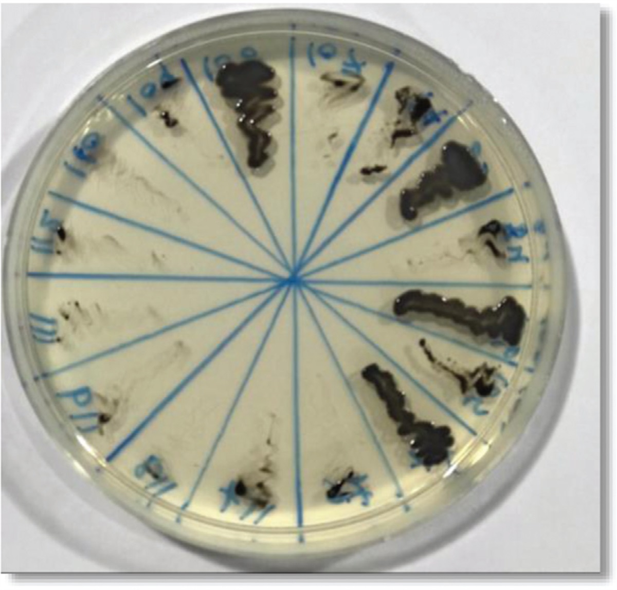 Emergence of hypervirulent Klebsiella pneumoniae isolates from some Iraqi hospitals