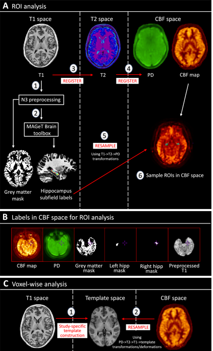 Effects of diazepam on hippocampal blood flow in people at clinical high risk for psychosis