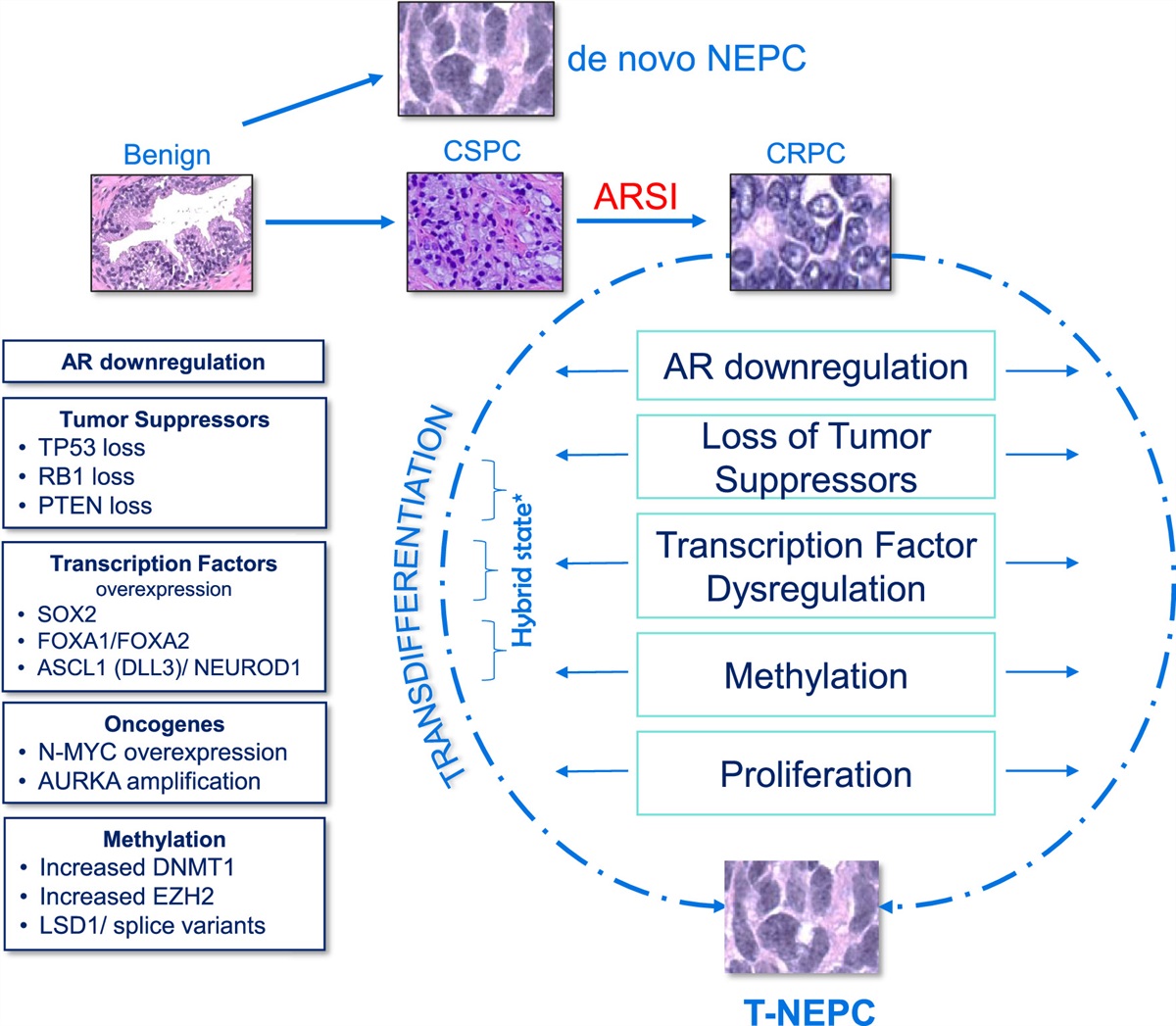 Treatment-related Neuroendocrine Prostate Carcinoma—Diagnostic and Molecular Correlates