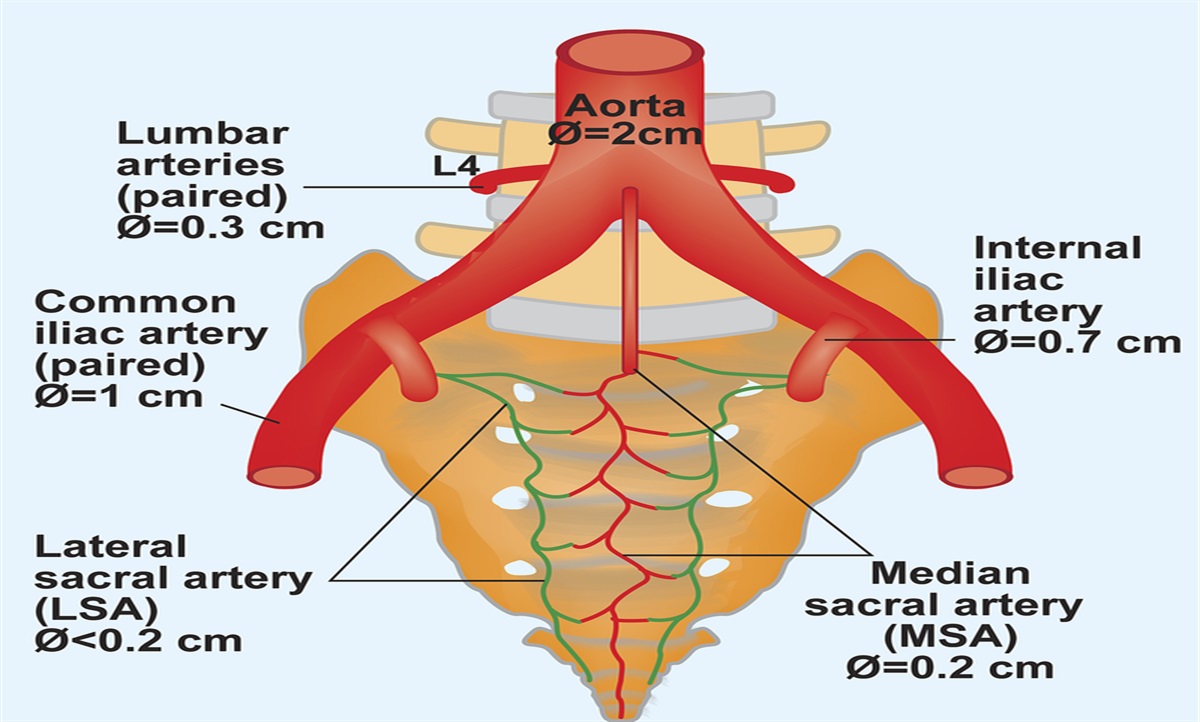 Kennedy Terminal Ulcers and Trombley-Brennan Terminal Tissue Injuries: Mystery Solved?