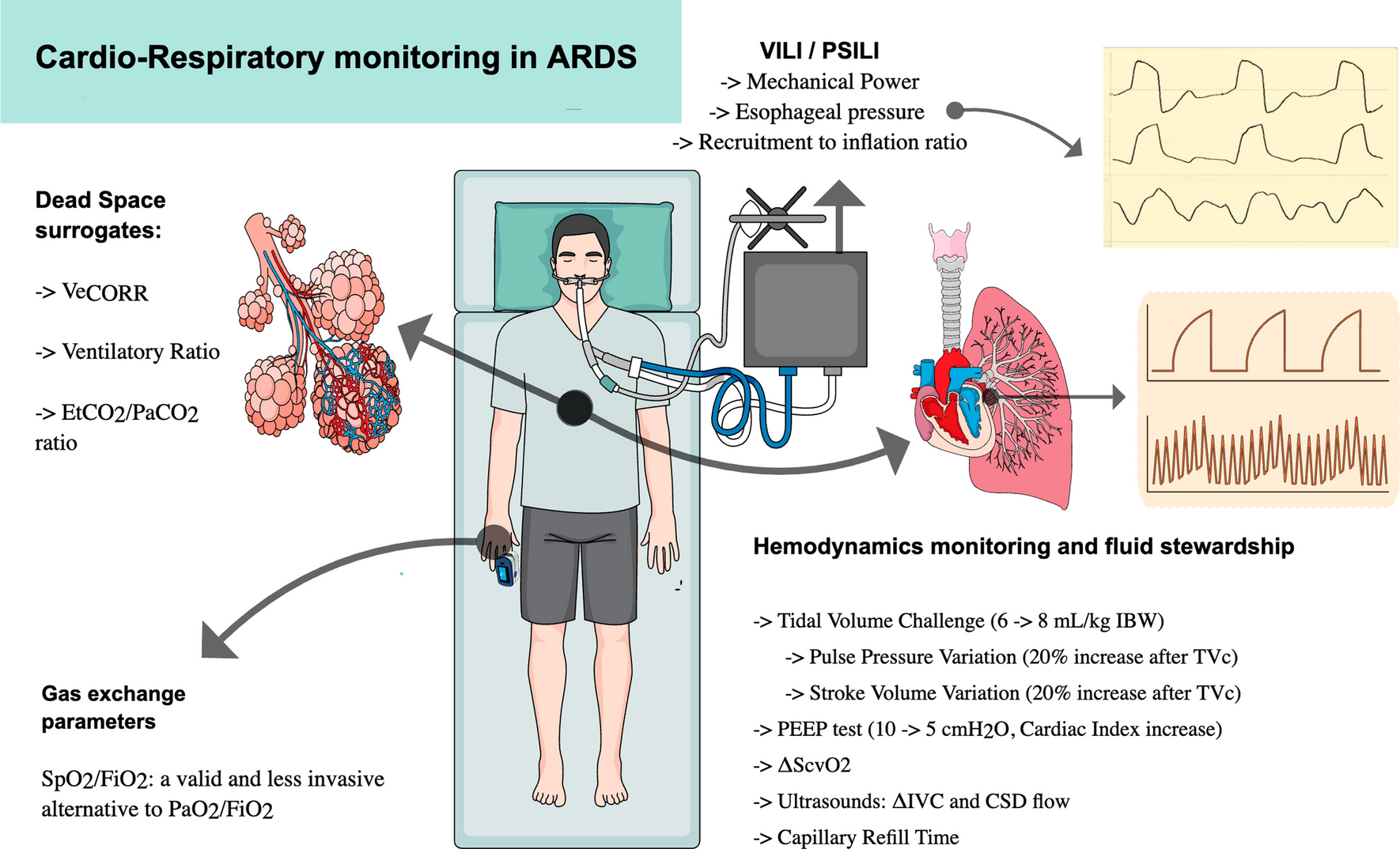 Recent advances in cardiorespiratory monitoring in acute respiratory distress syndrome patients