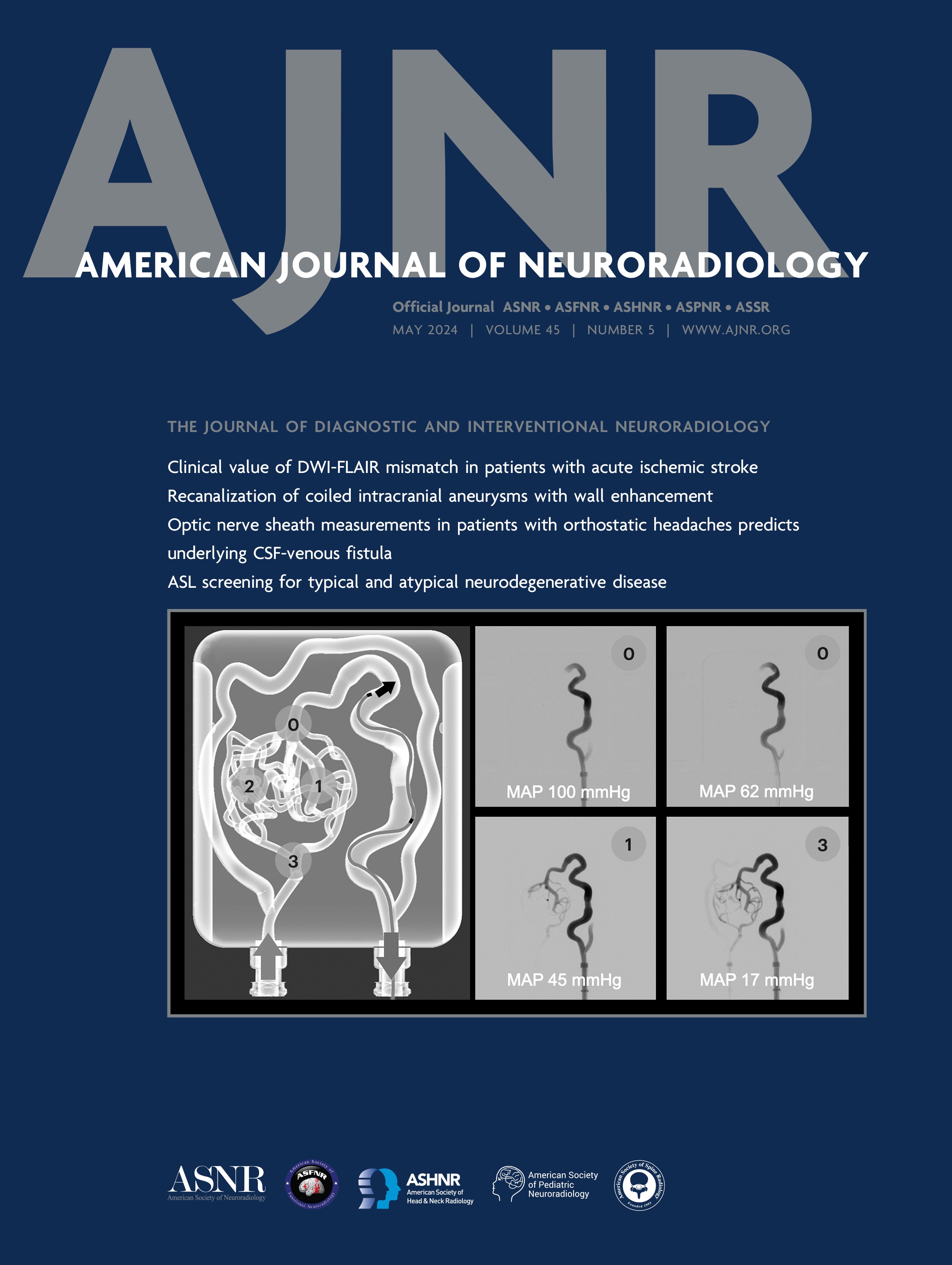 Implementation of a Clinical Vessel Wall MR Imaging Program at an Academic Medical Center [NEUROVASCULAR/STROKE IMAGING]