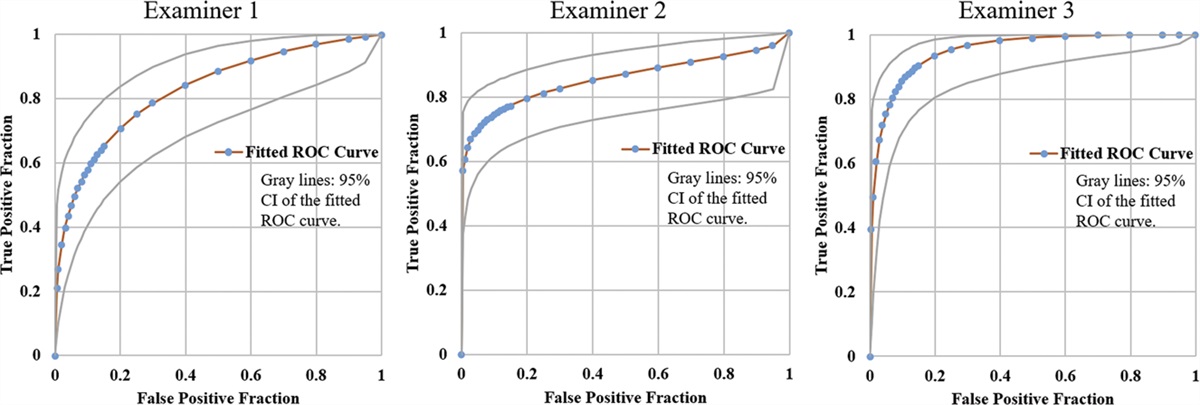 Sensitivity and specificity of SS-OCT for detecting macular pathologies vs SD-OCT