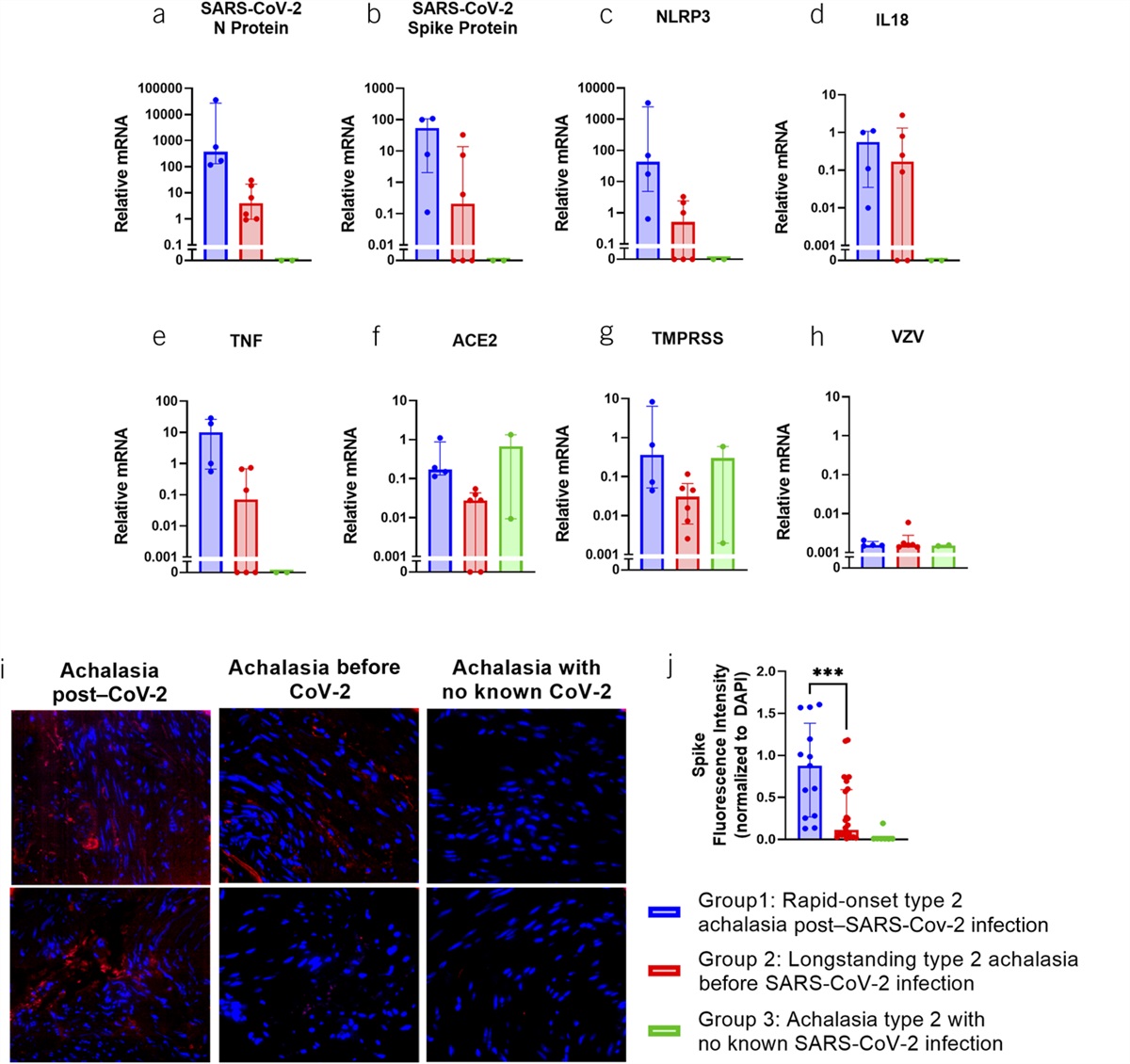 Rapid Development of Achalasia After SARS-CoV-2 Infection: Polymerase Chain Reaction Analysis of Esophageal Muscle Tissue