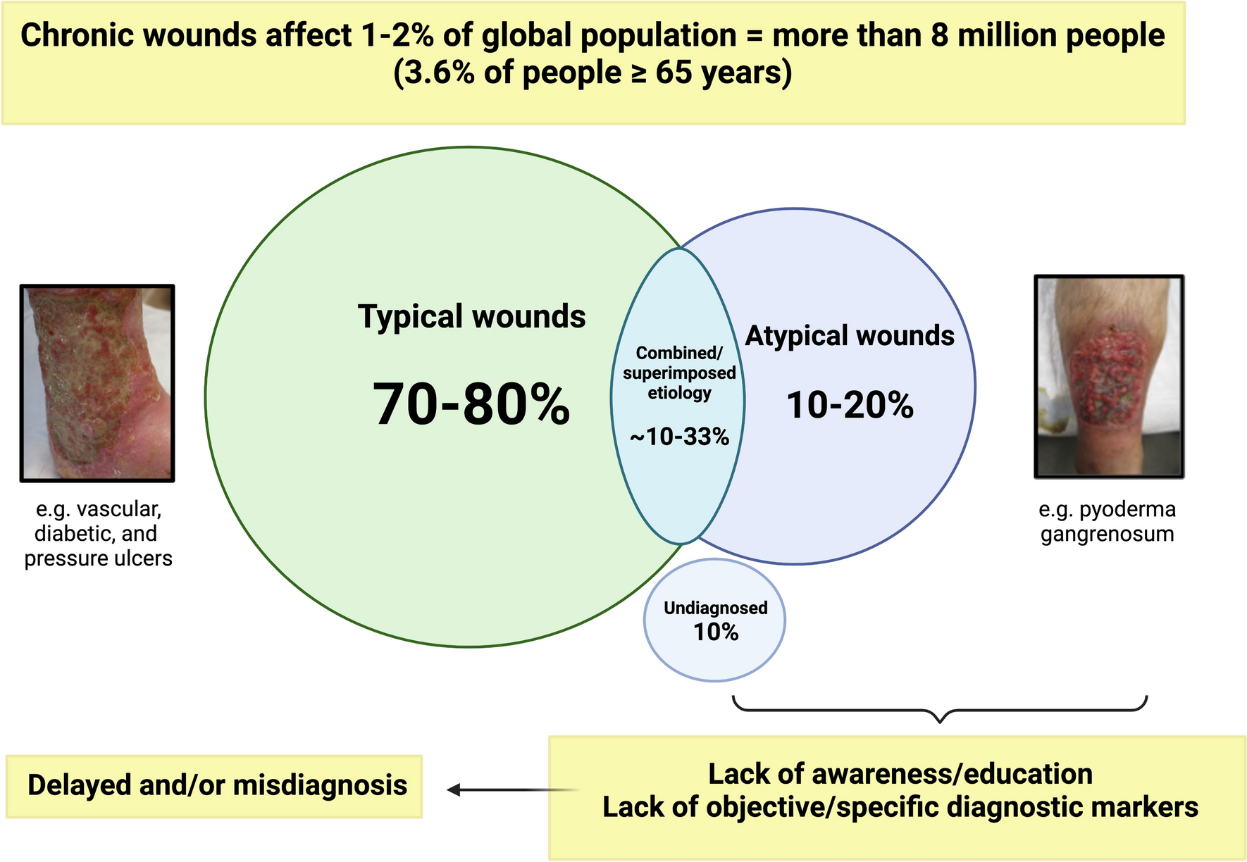 Approach to the Atypical Wound