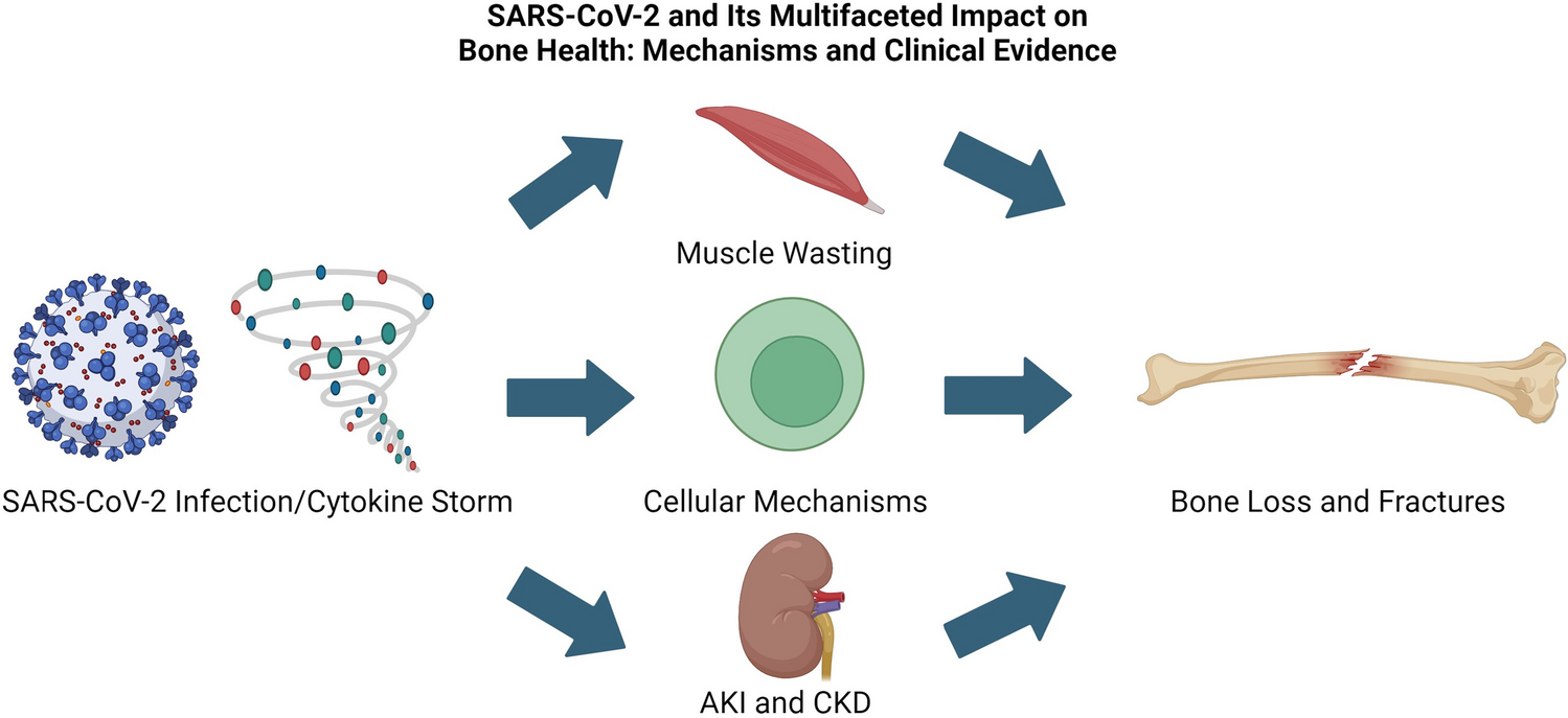 SARS-CoV-2 and its Multifaceted Impact on Bone Health: Mechanisms and Clinical Evidence