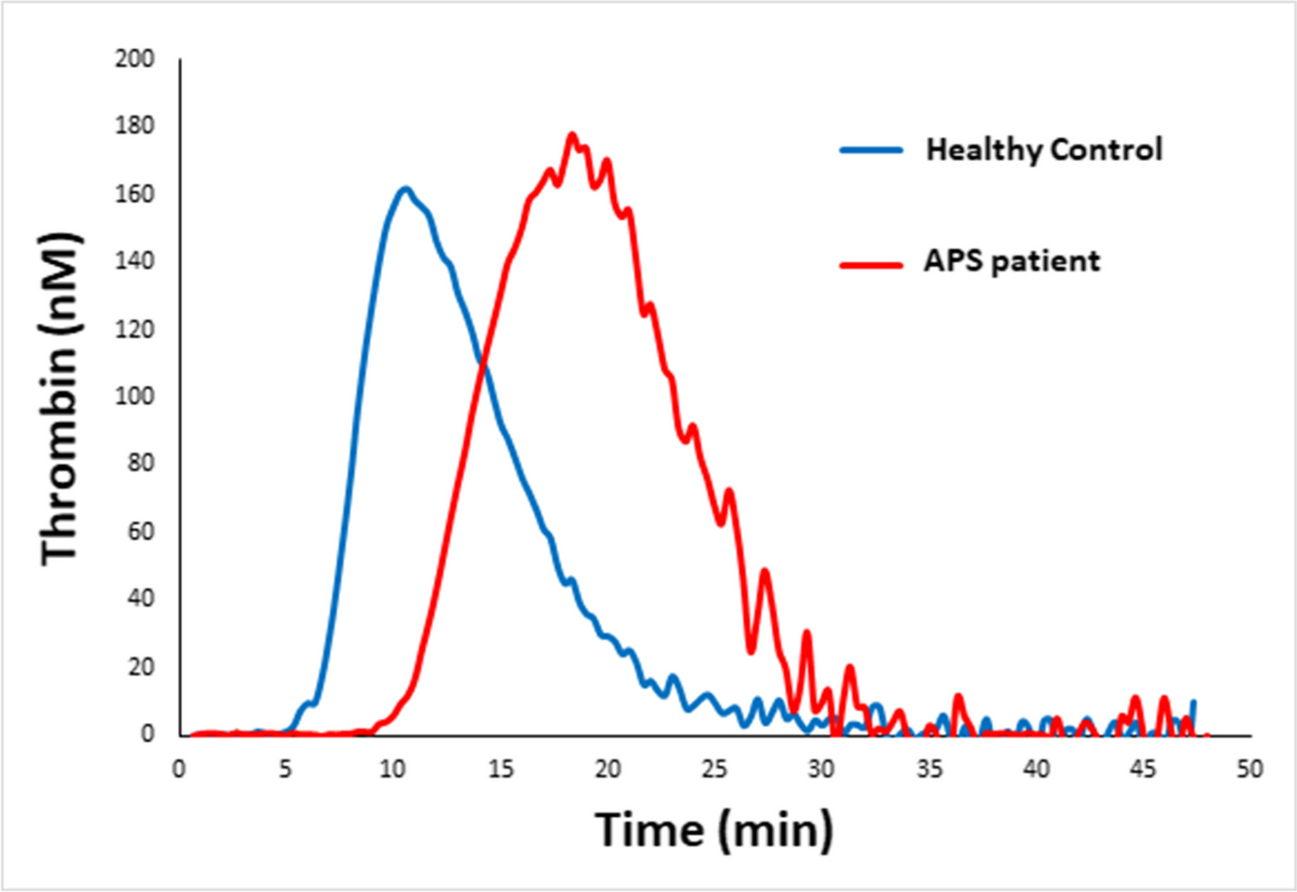 Thrombin Generation Assay in Antiphospholipid Antibodies Positive Subjects as a Personalized Thrombotic Risk Assessment: State of the Art and Perspectives