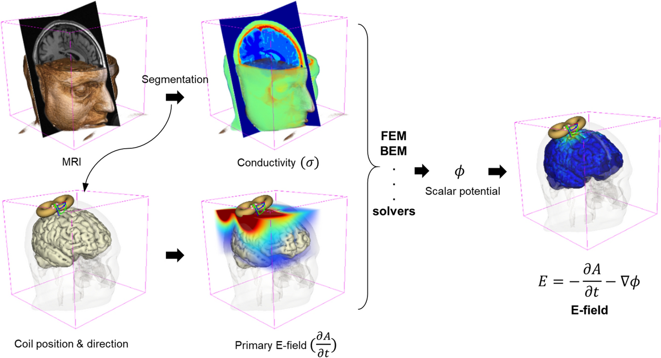 A review of algorithms and software for real-time electric field modeling techniques for transcranial magnetic stimulation