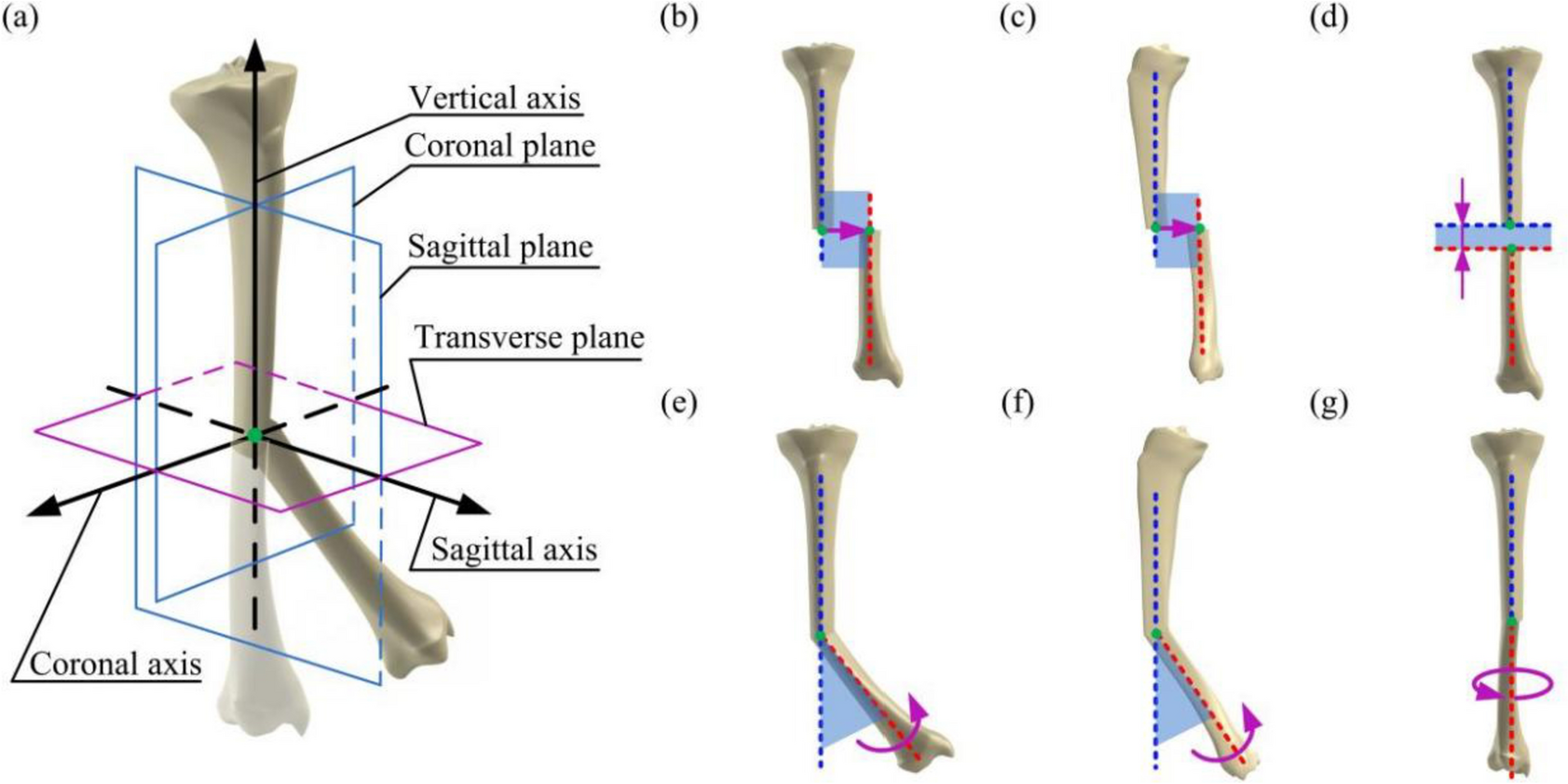A novel approach to characterize the correction path features for the tibia deformity correction