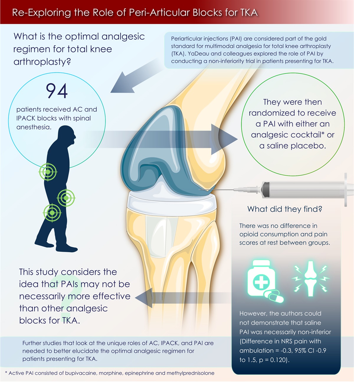 Re-Exploring the Role of Peri-Articular Blocks for TKA