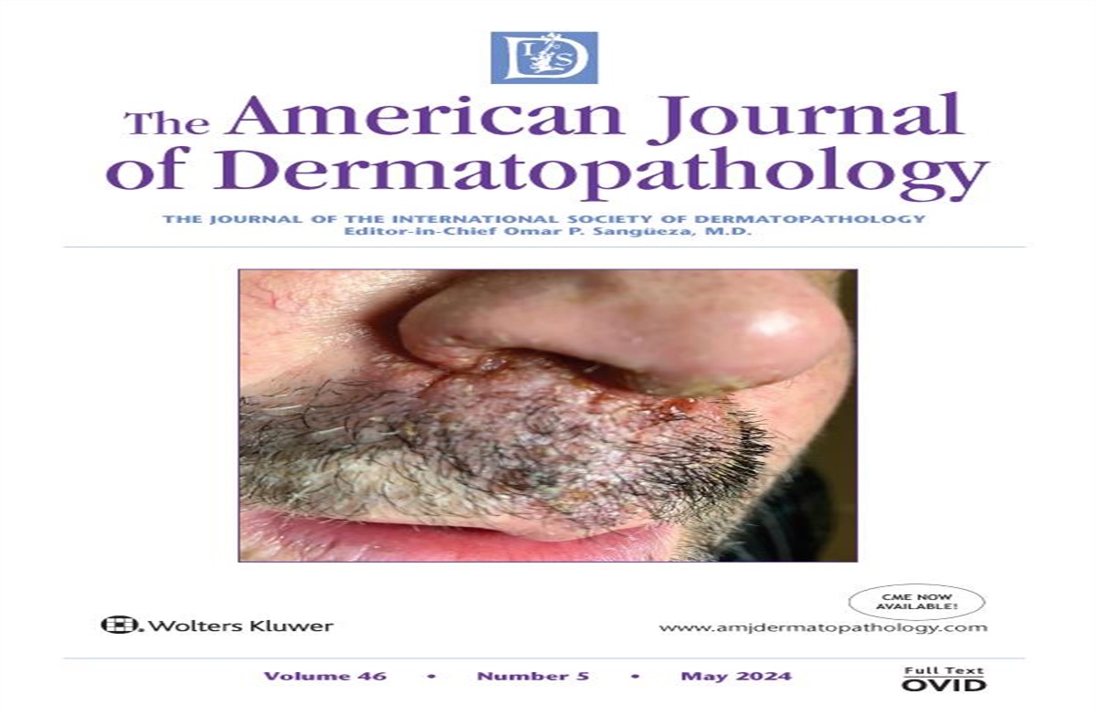 Bullous Dermatosis on the Whole Body: Answer