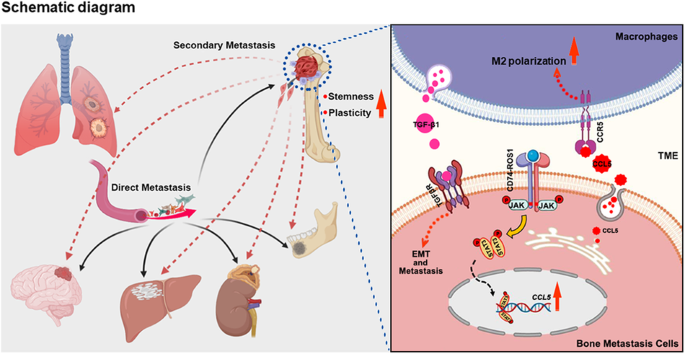 Bone-metastatic lung adenocarcinoma cells bearing CD74-ROS1 fusion interact with macrophages to promote their dissemination