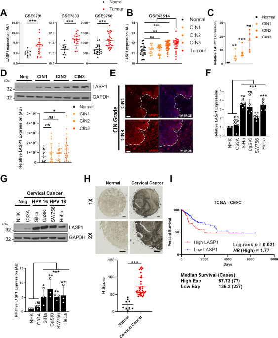 E7-mediated repression of miR-203 promotes LASP1-dependent proliferation in HPV-positive cervical cancer
