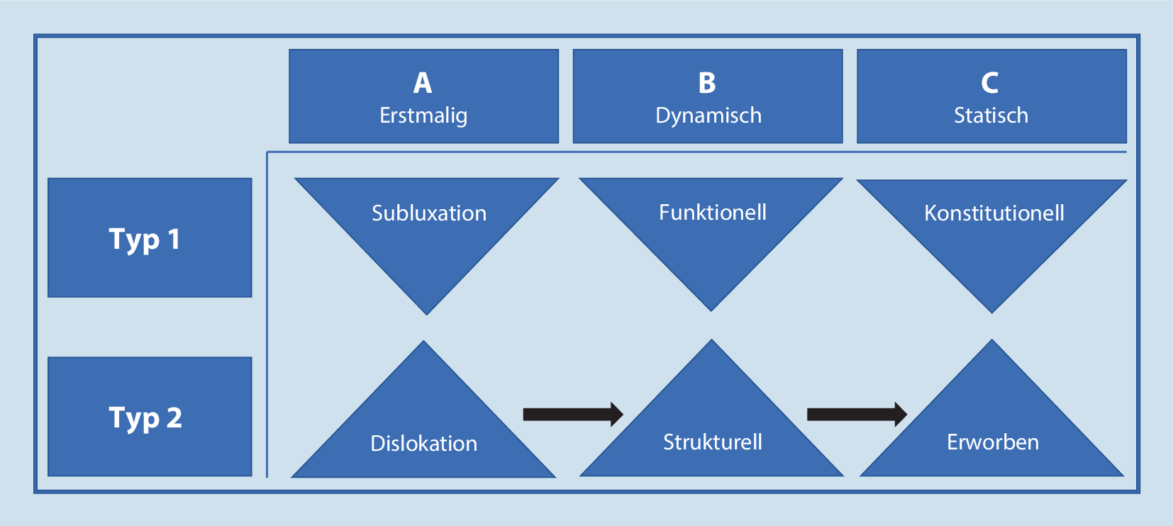 Arthroskopische Defektaufstößelung der reversen Engaging-Hill-Sachs-Läsion