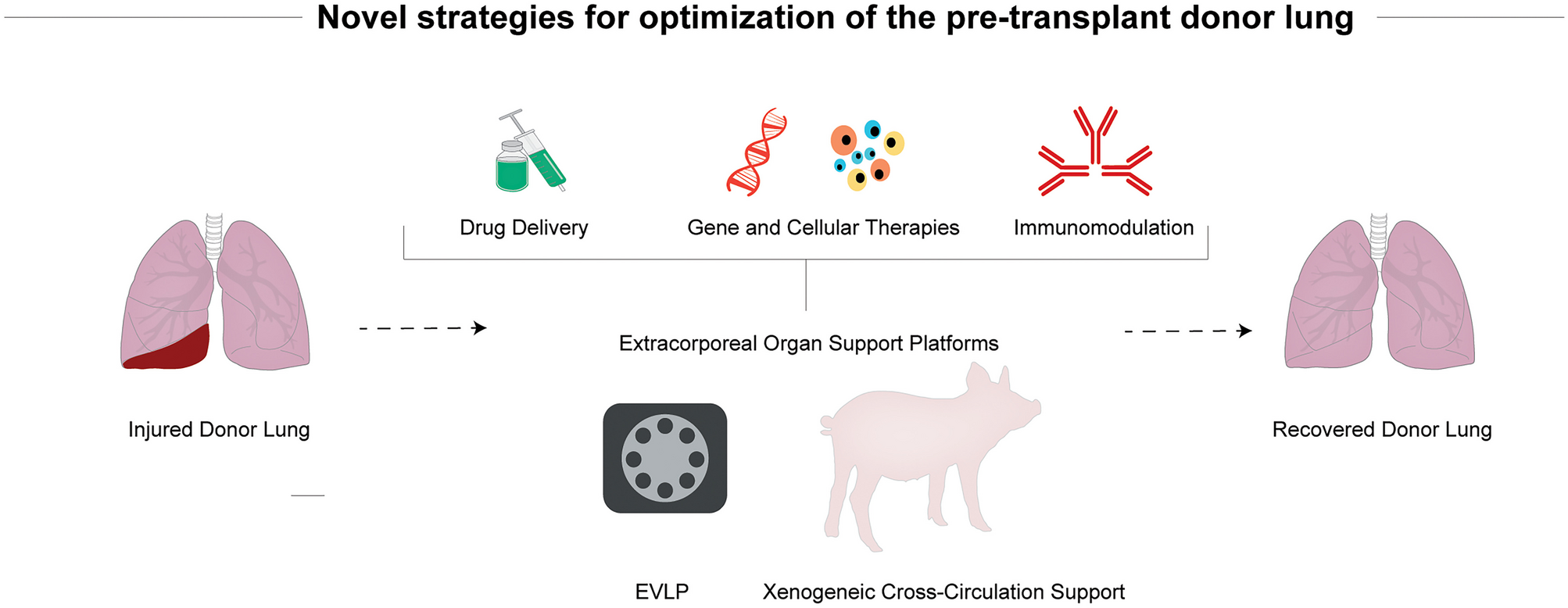 Novel Strategies for Optimization of the Pre-transplant Donor Lung