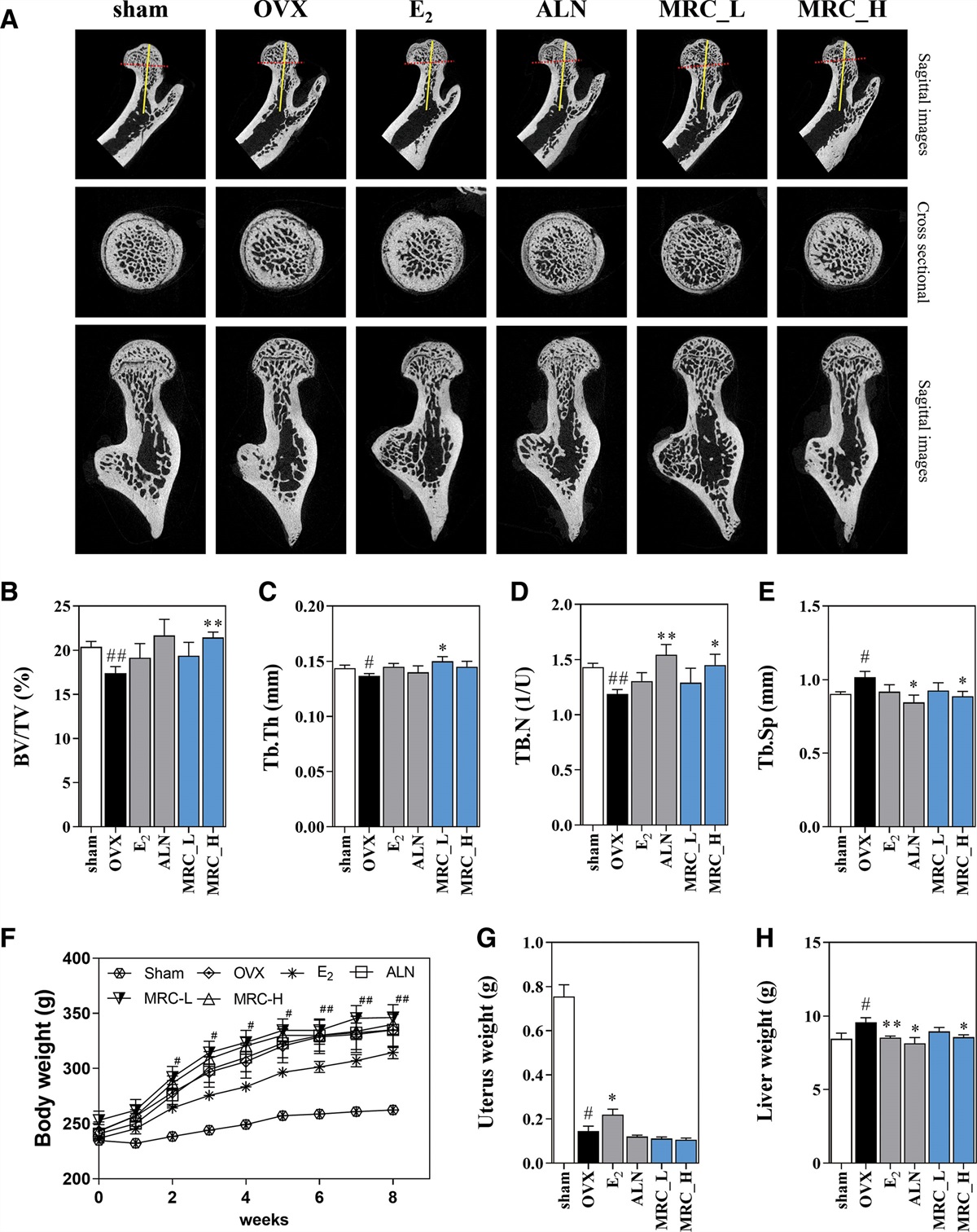Suppression of bone resorption by Mori Radicis Cortex through NFATc1 and c-Fos signaling-mediated inhibition of osteoclast differentiation