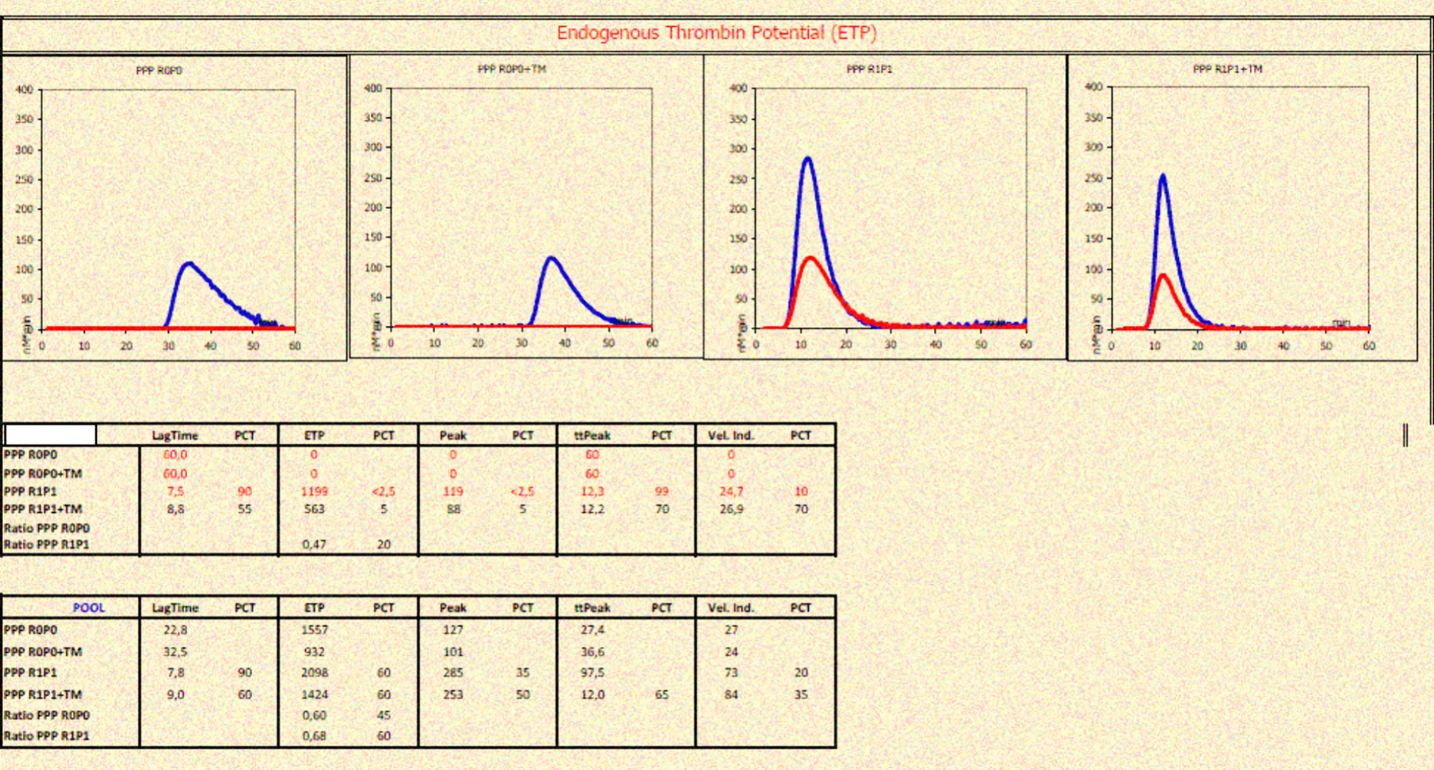 A case of lymphadenopathies with concomitant multiple acquired hemostasis disorders in an adult female patient