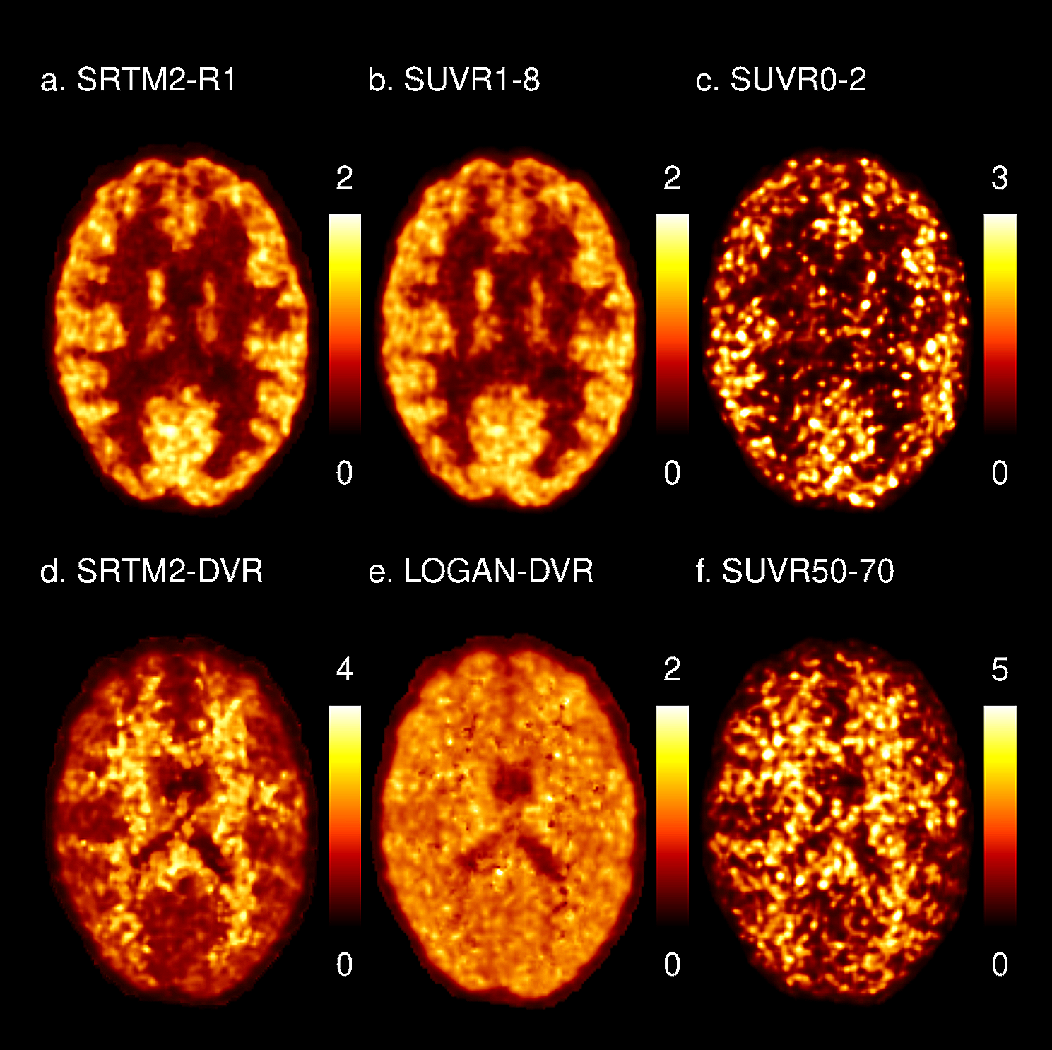 Simultaneous assessment of blood flow and myelin content in the brain white matter with dynamic [11 C]PiB PET: a test-retest study in healthy controls