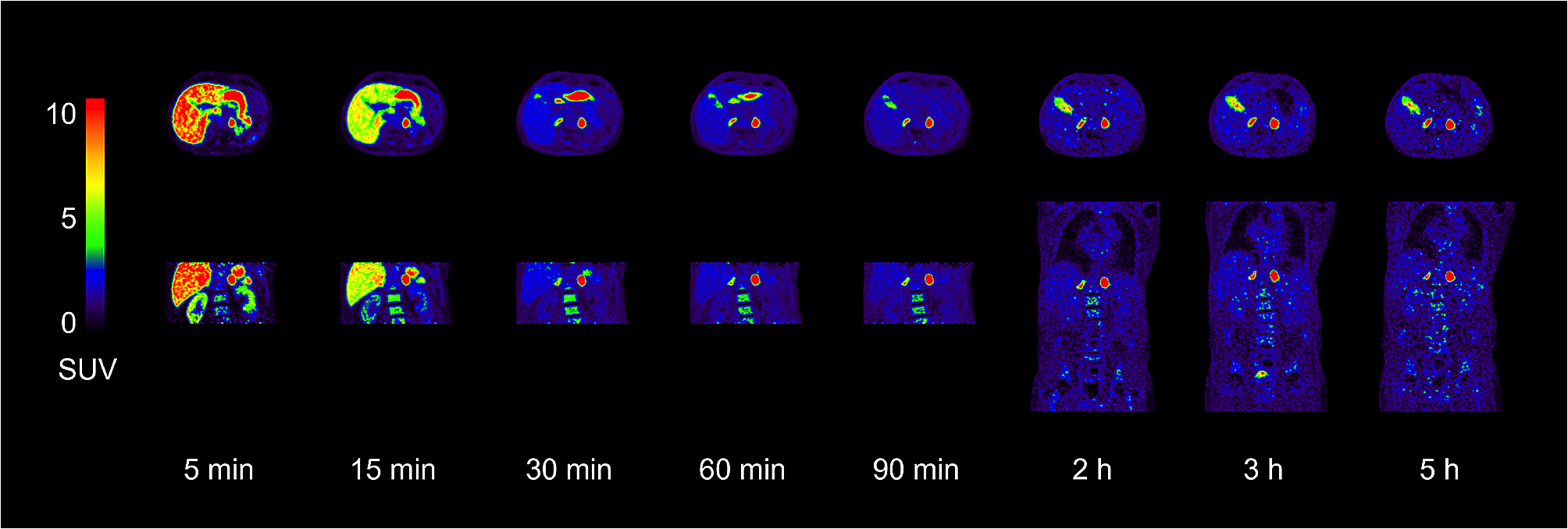 Radiation dosimetry of para-chloro-2-[18F]fluoroethyl-etomidate: a PET tracer for adrenocortical imaging