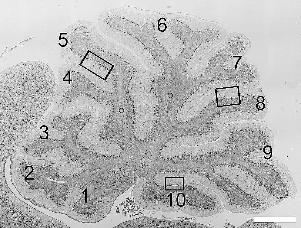 The Spinocerebellar Ataxia 34-Causing W246G ELOVL4 Mutation Does Not Alter Cerebellar Neuron Populations in a Rat Model