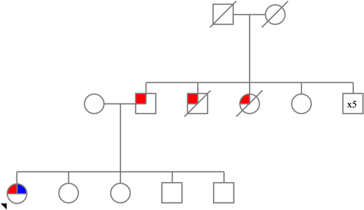 A Case of Coexistent Spinocerebellar Ataxia Type 2 and Primary Progressive Multiple Sclerosis—Coincidental or Associated?