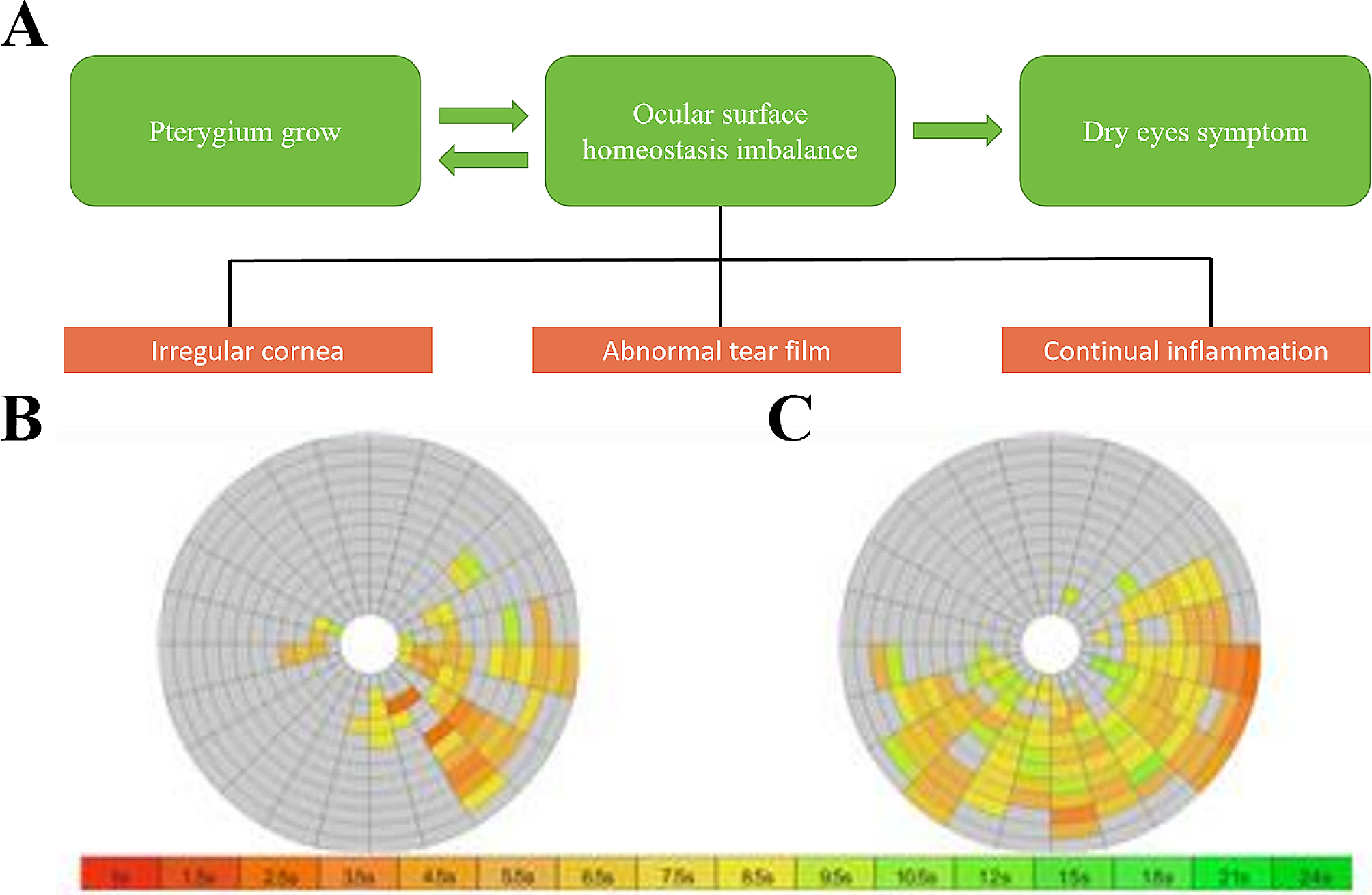 Inflammation due to ocular surface homeostasis imbalance caused by pterygia: tear lymphotoxin-alpha study and a literature review